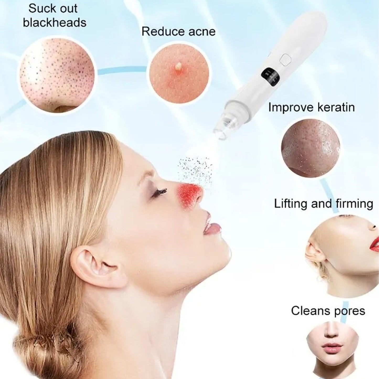 Blackhead Extractor Rechargeable USB Port Blackhead Remover 3 Speeds Control Pore Vacuum with 5 Probes Pore Extractor Portable Pimple for Women and Men White|Beauty Instrument