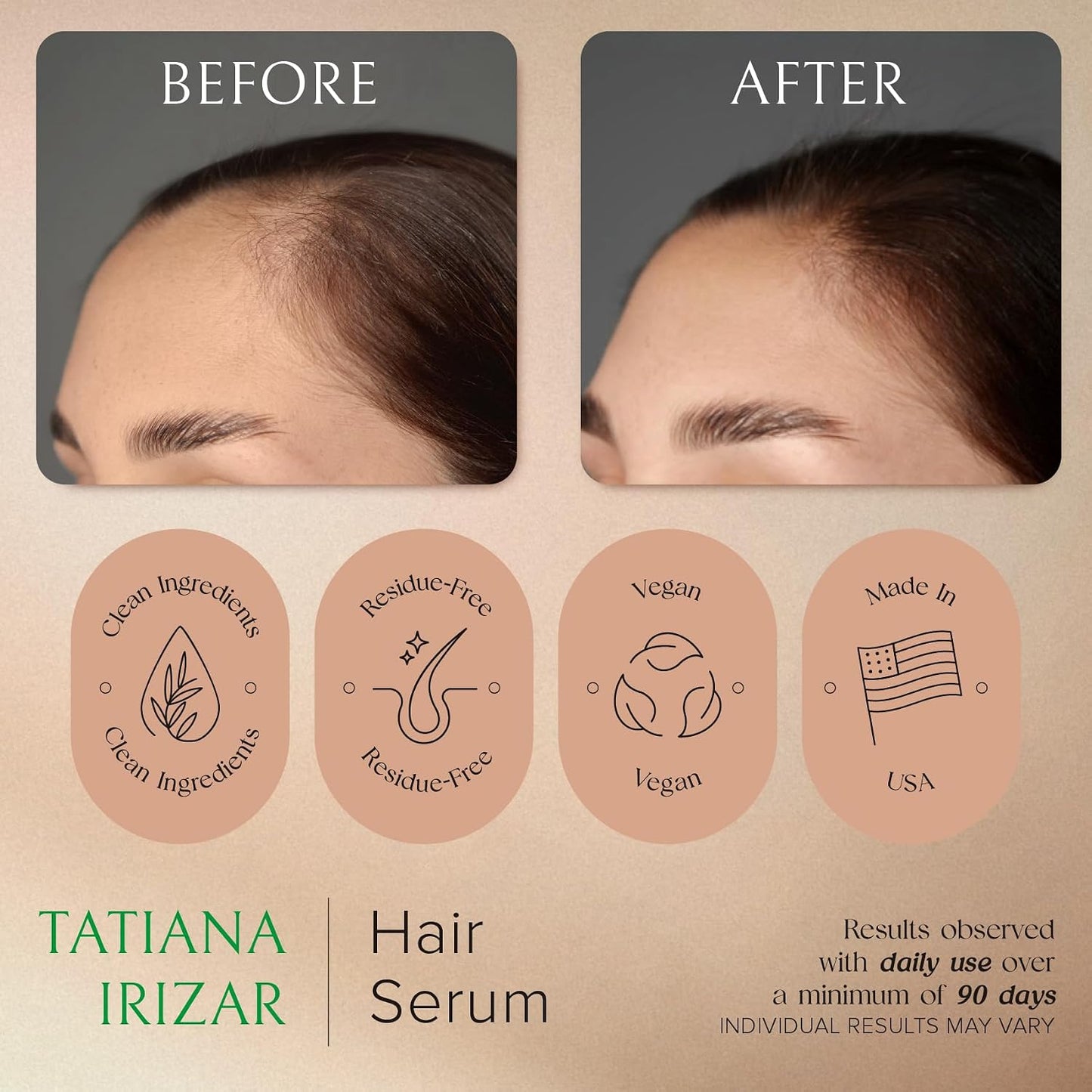 Hair Growth Serum for Women - Non-Greasy Rosemary & Amla Treatment | 3 Pack, 1 Oz Each