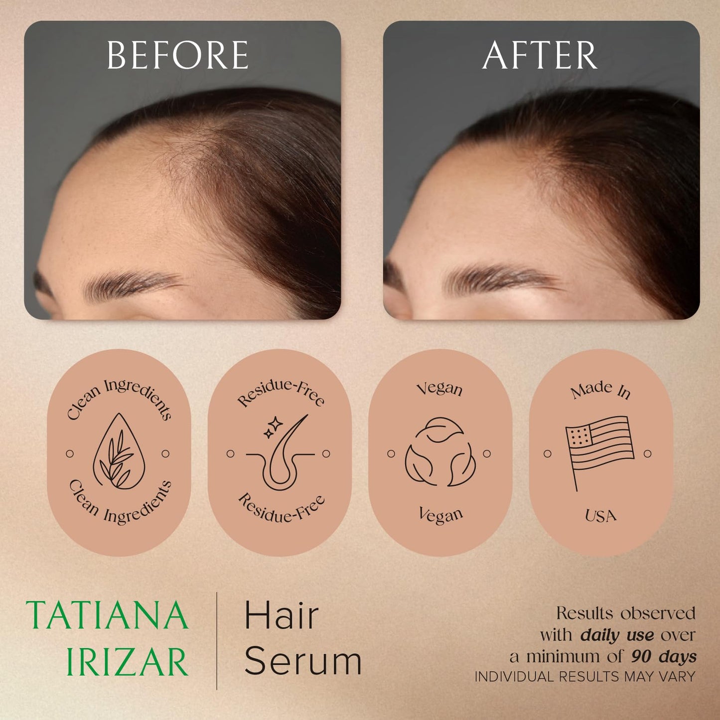 Caffeine Hair Growth Serum Women Made in USA - Scalp Serum For Hair Growth Non-Greasy Biotin Rosemary, Amla & Caffeine - 1 Fl.Oz Residue-Free Gotero Anticaida y Crecimiento - Hair Regrowth Treatments