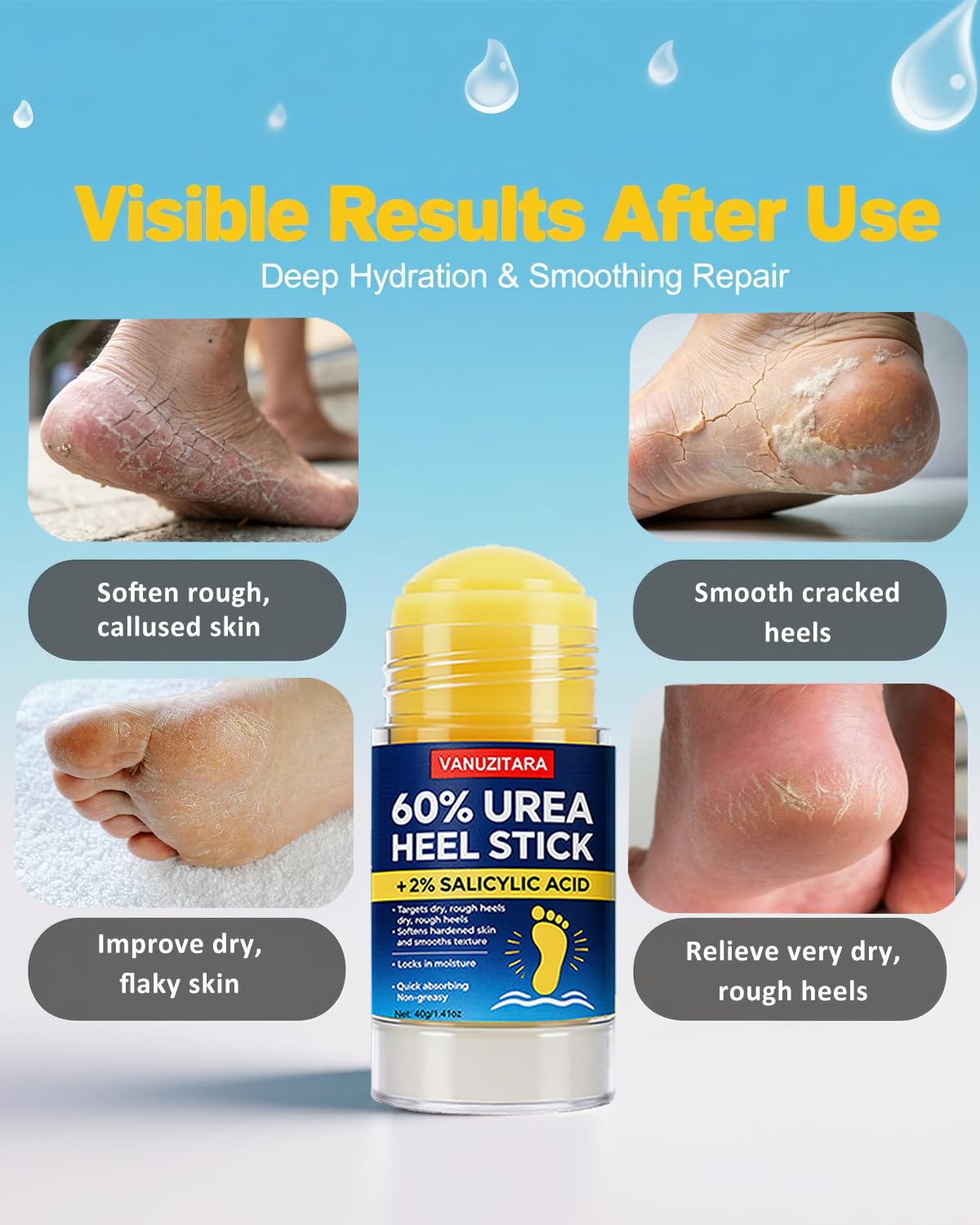 Urea Cream 60% with 2% Salicylic Acid - Maximum Strength Foot & Hand Cream for Dry, Cracked Skin | 1.41oz