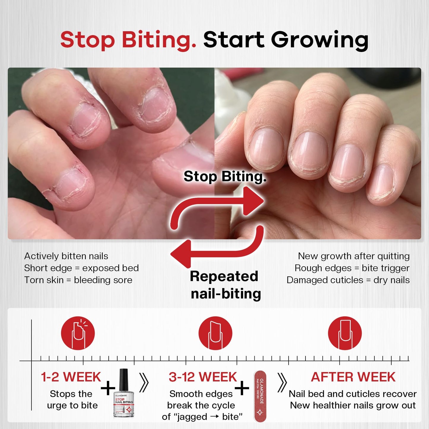 Glamonade 2-in-1 Stop Nail Biting Treatment Kit: Extra Bitter Polish to Deter Biting & Professional Nail File to Smooth Jagged Edges Complete Solution to Remove Biting Triggers for Kids & Adults