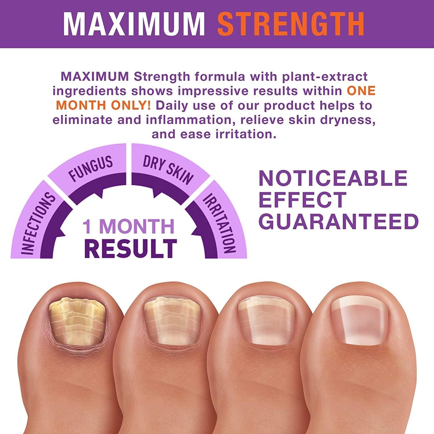 Toenail Fungus Treatment Kit - Extra Strength Fungal Nail Renewal with 25% Undecylenic Acid | 1 Oz Nail Repair Liquid & File