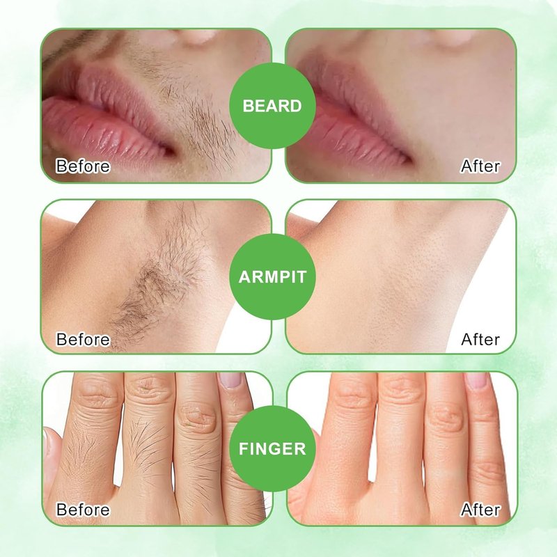 Facial Wax Strips - 98% Natural, Hypoallergenic Hair Removal for All Skin Types | Gentle & Quick for Eyebrows, Upper Lip, Chin, Legs, Bikini Line