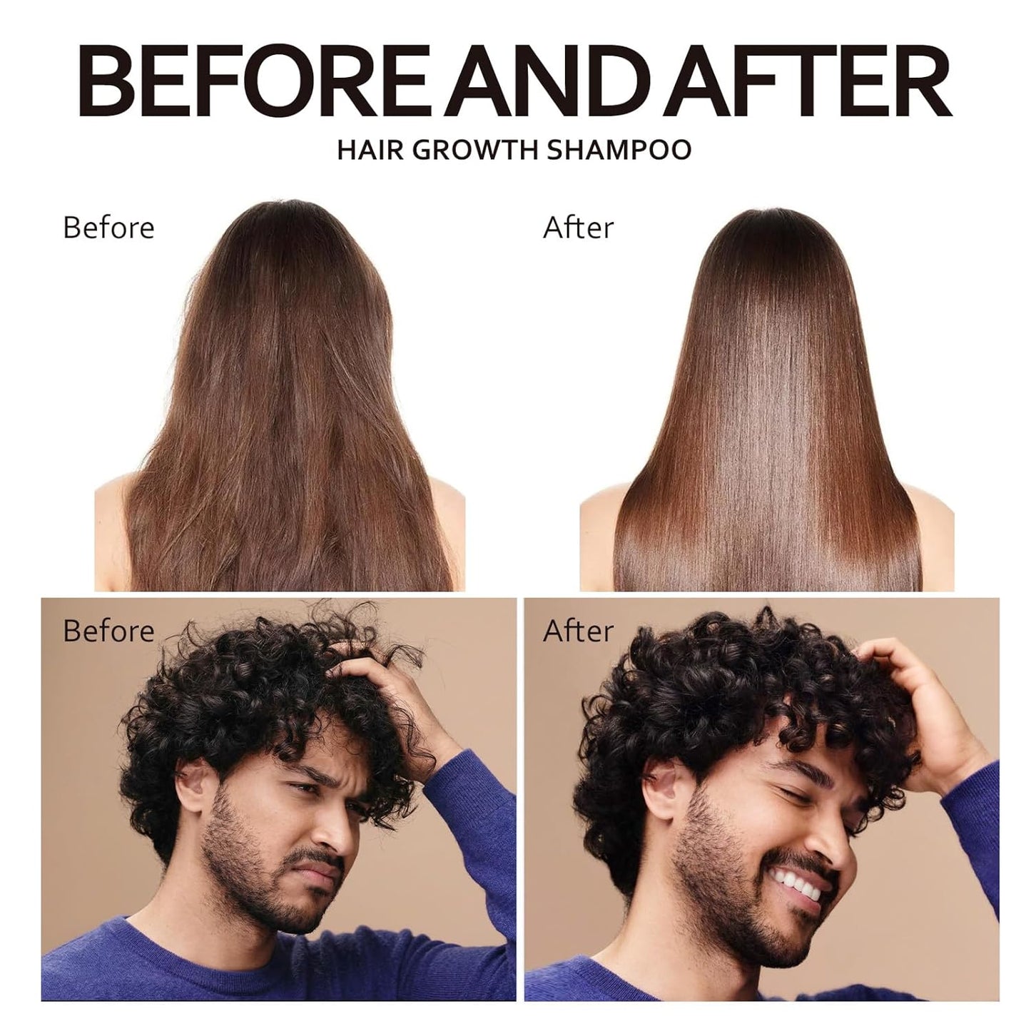 Biotin & Rosemary Hair Growth Shampoo - Nourishing Formula for Thinning Hair | 300 ml