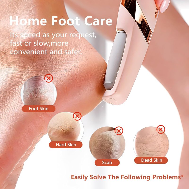 Electric Foot Callus Remover - Rechargeable Pedicure Tool for Smooth Feet Care | Ideal Gift in Pink