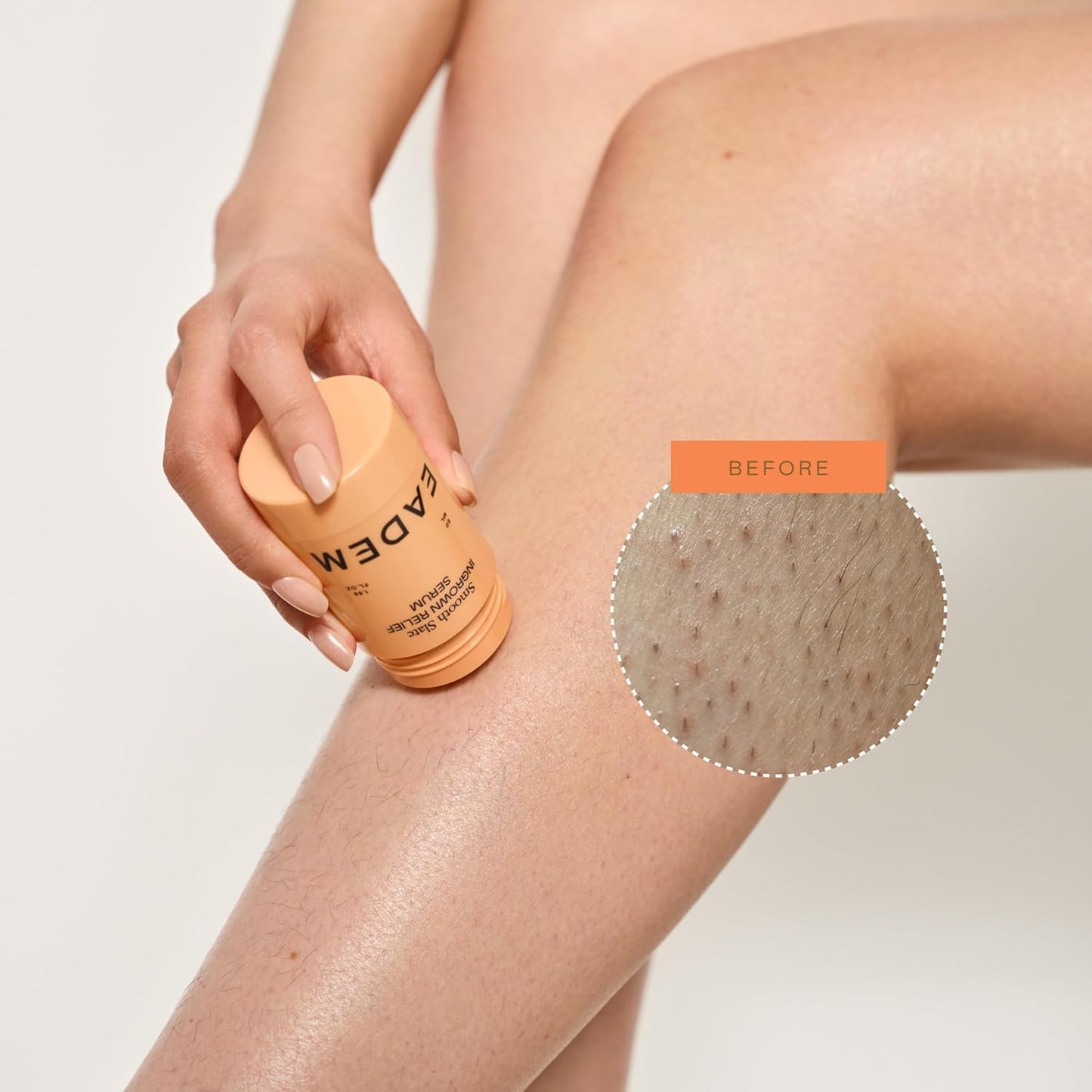 Eadem Smooth Slate Ingrown Hair Roller Serum - Targets Bumps & Faded Scars | AHAs for Dark Spots