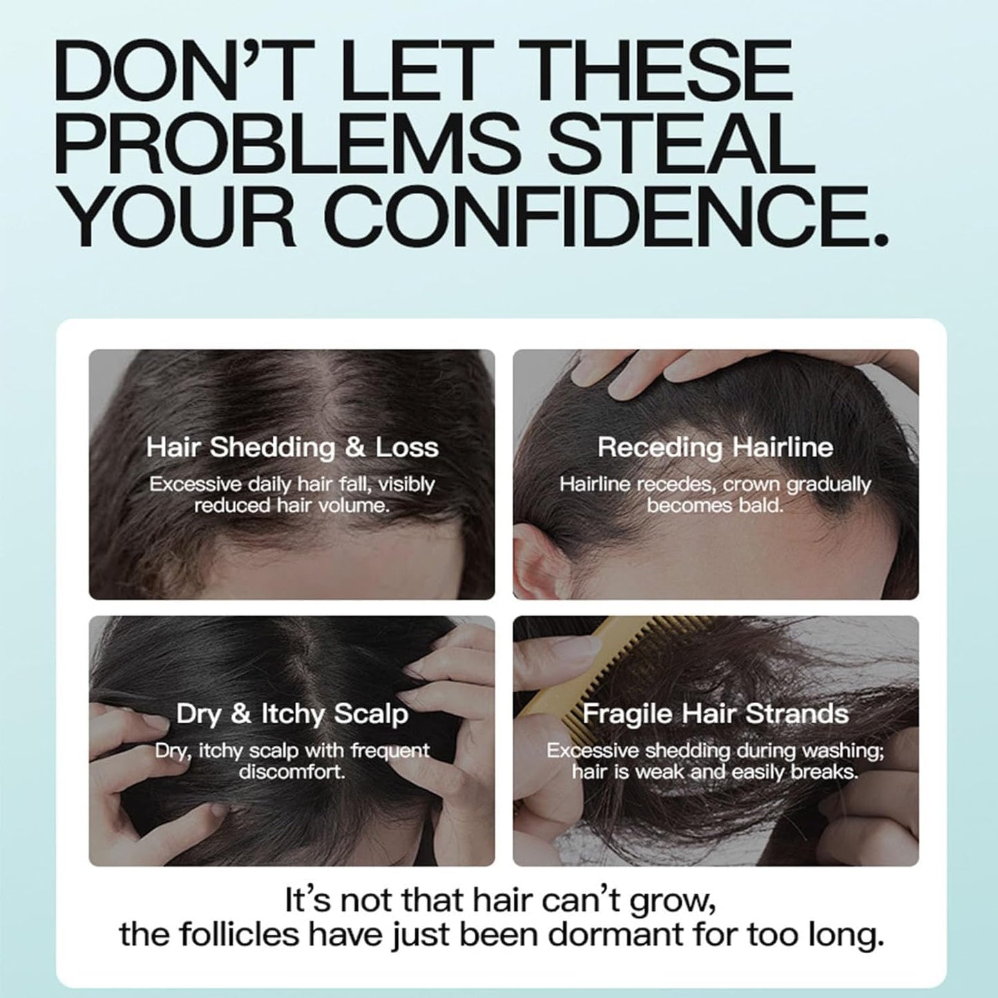 Minoxidil Hair Growth Cream - Anti Hair Loss Treatment with Rosemary & Biotin | For Men & Women, 5% Formula