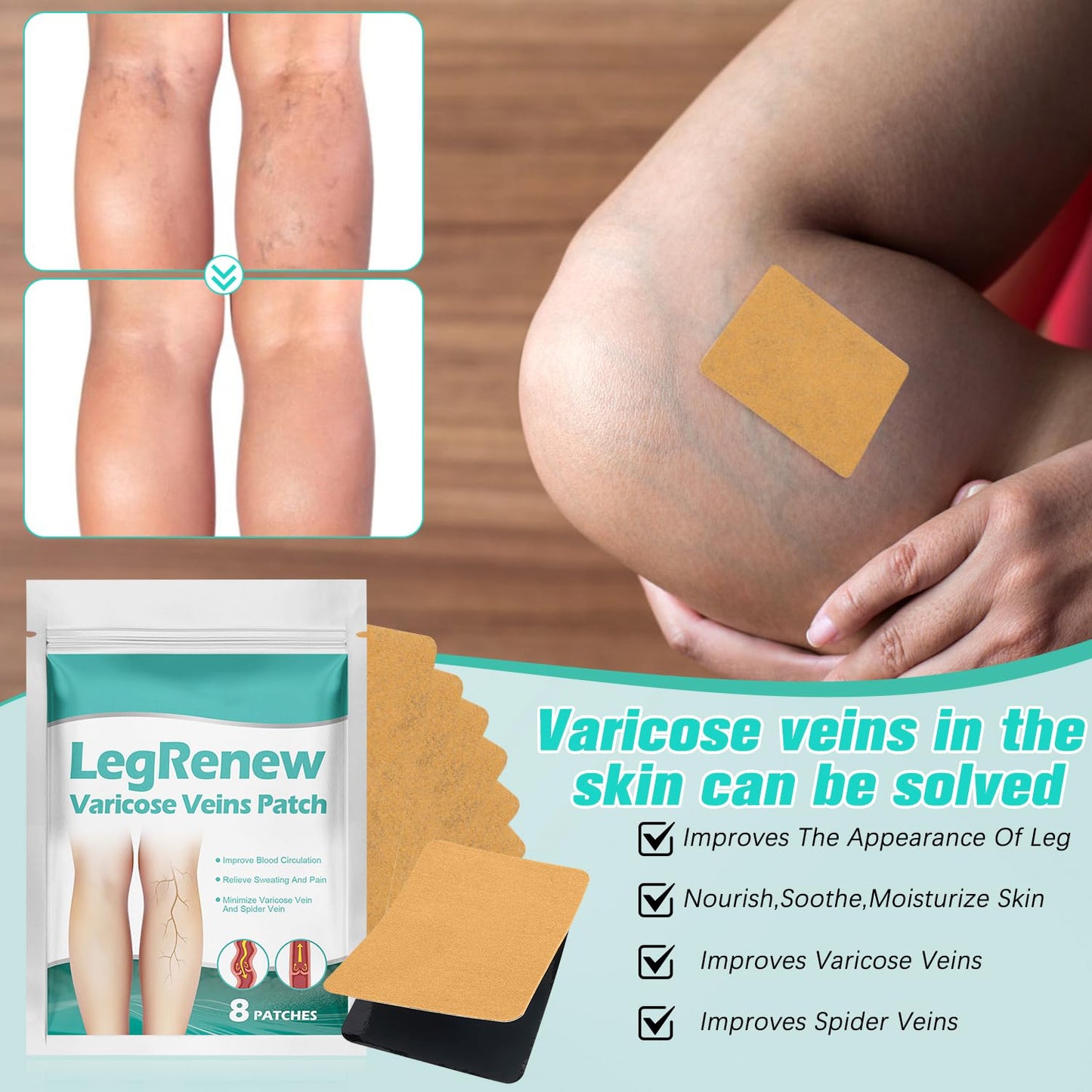 Leg Renew Varicose Veins Patch - Natural Treatment for Varicose Veins | 2 Packs, All Skin Types