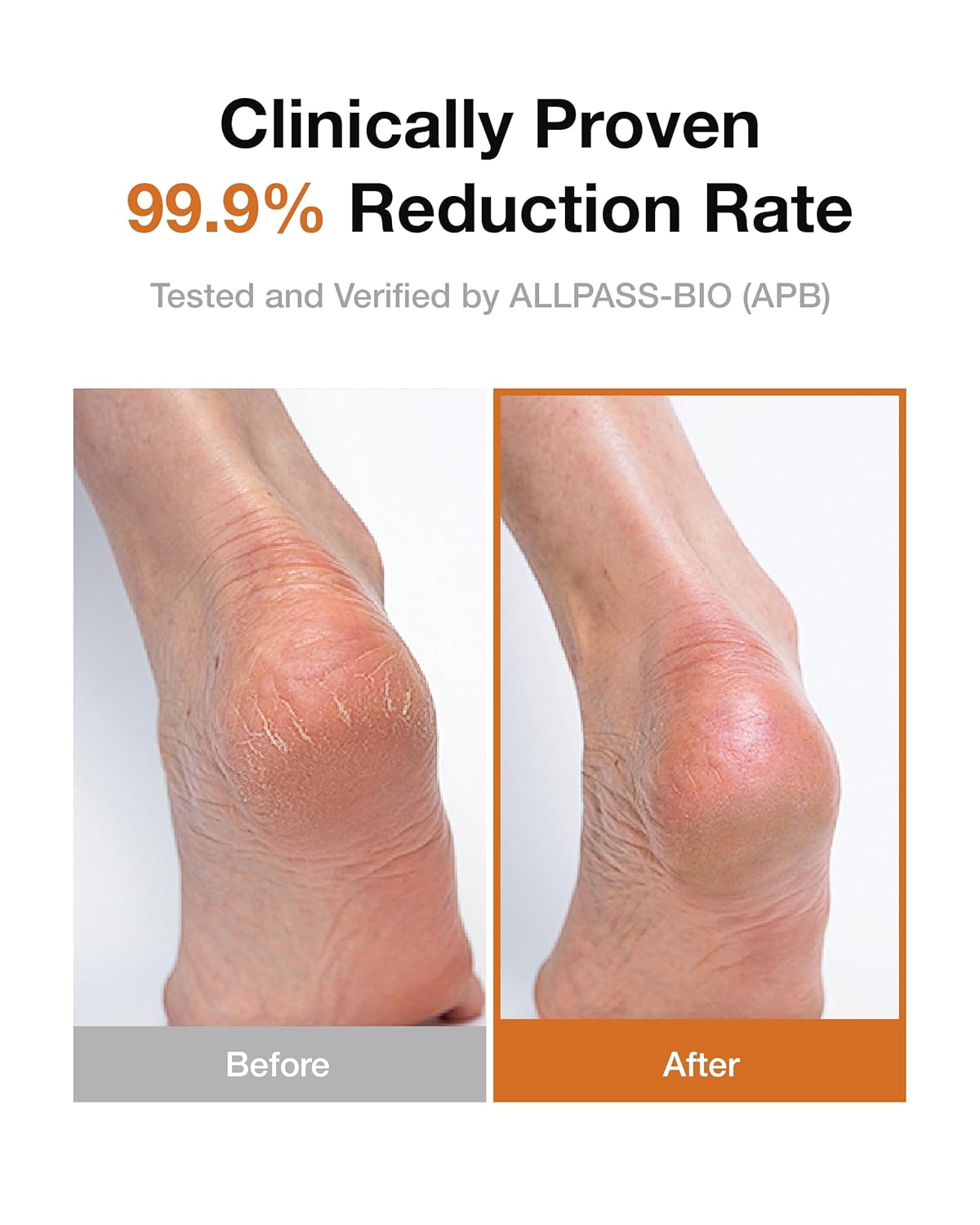 Foot Repair Cream - Intensive Moisturizer for Dry, Cracked Heels & Calluses | Shea Butter & Magnolia Extract Formula