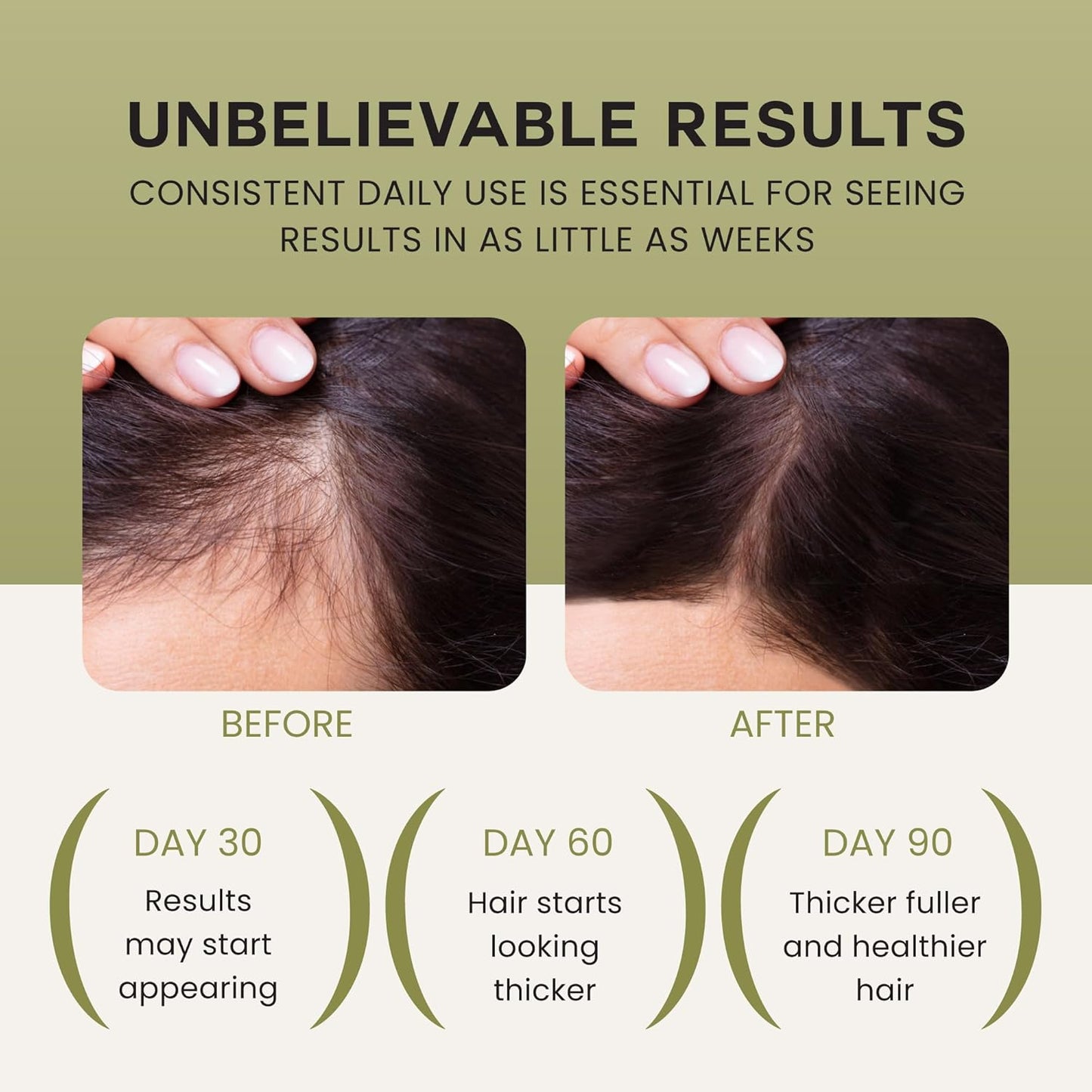 Lebanta Batana Oil for Hair Growth - 100% Pure Organic Blend with Castor, Pumpkin Seed & Rosemary | Thicker, Stronger Hair (1 Pack)