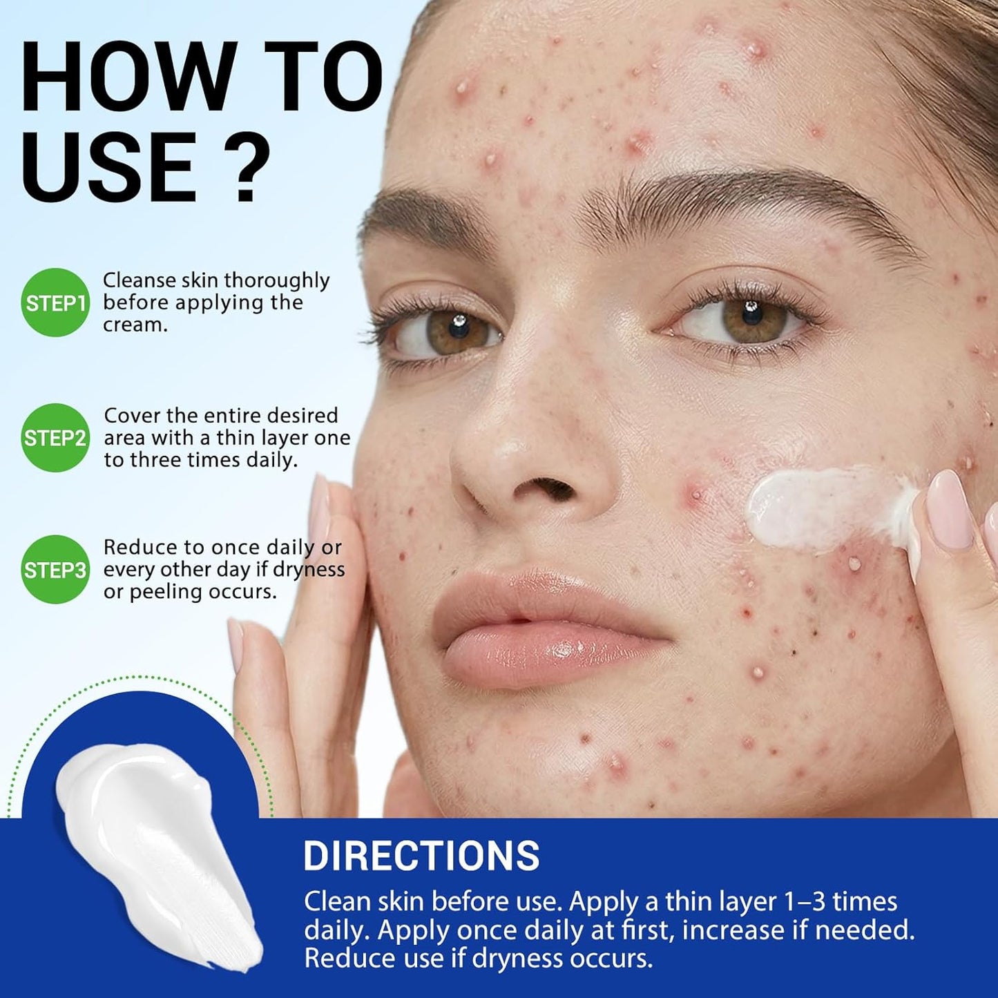 Folliculitis & Acne Cream - Hydrating Formula for Scalp, Face, Body & Butt | Soothes Irritated Skin, 120g