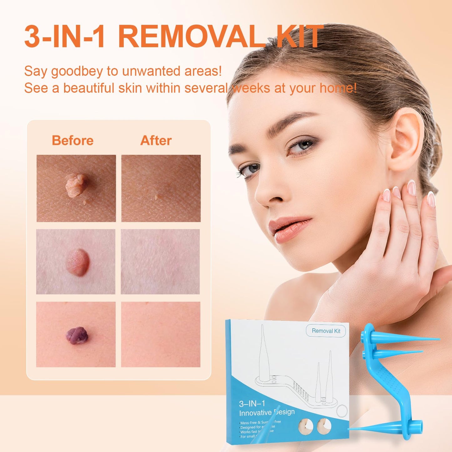 Nodhaul AL-40 Skin Removal Kit, Removal Tools for Home use, Best Tools to Make Your Better, Beauty Remover kIt for Men & Women