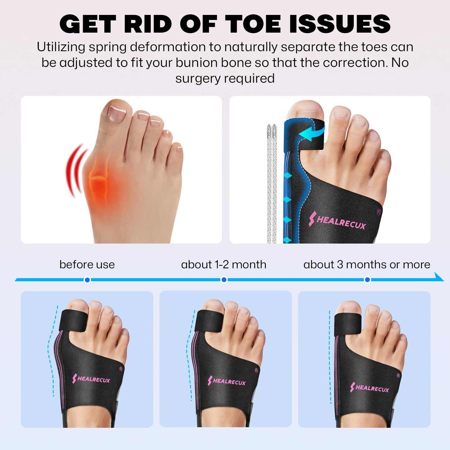 Healrecux Bunion Corrector & Hammer Toe Splint - with Flexible Steel Springs & Cushion Pad, Hallux Valgus Corrector for Strong Alignment & Pain Relief, Bunion Brace for Women Men - Pink Stripes