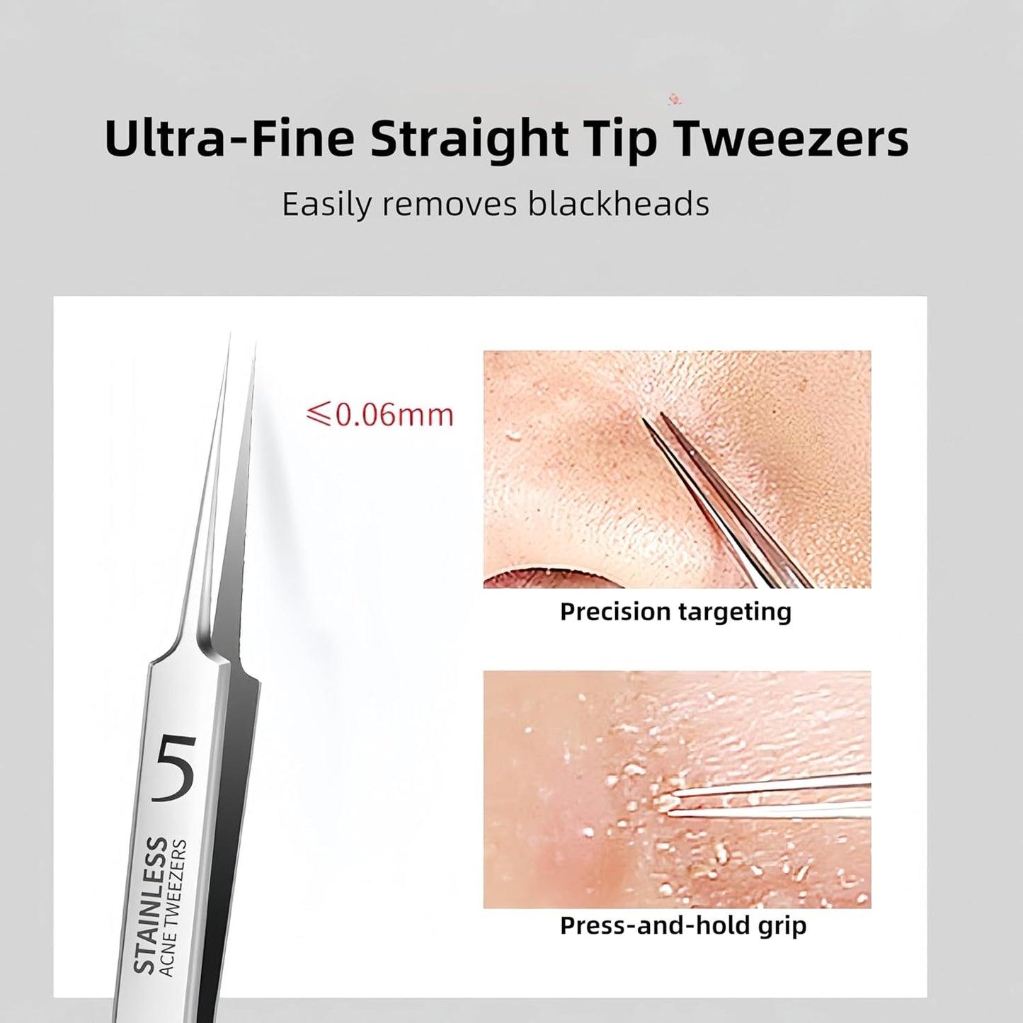 Blackhead Tweezers Set - Precision Stainless Steel Acne Removal Kit | 3-Piece Tool for Pimples & Ingrown Hairs