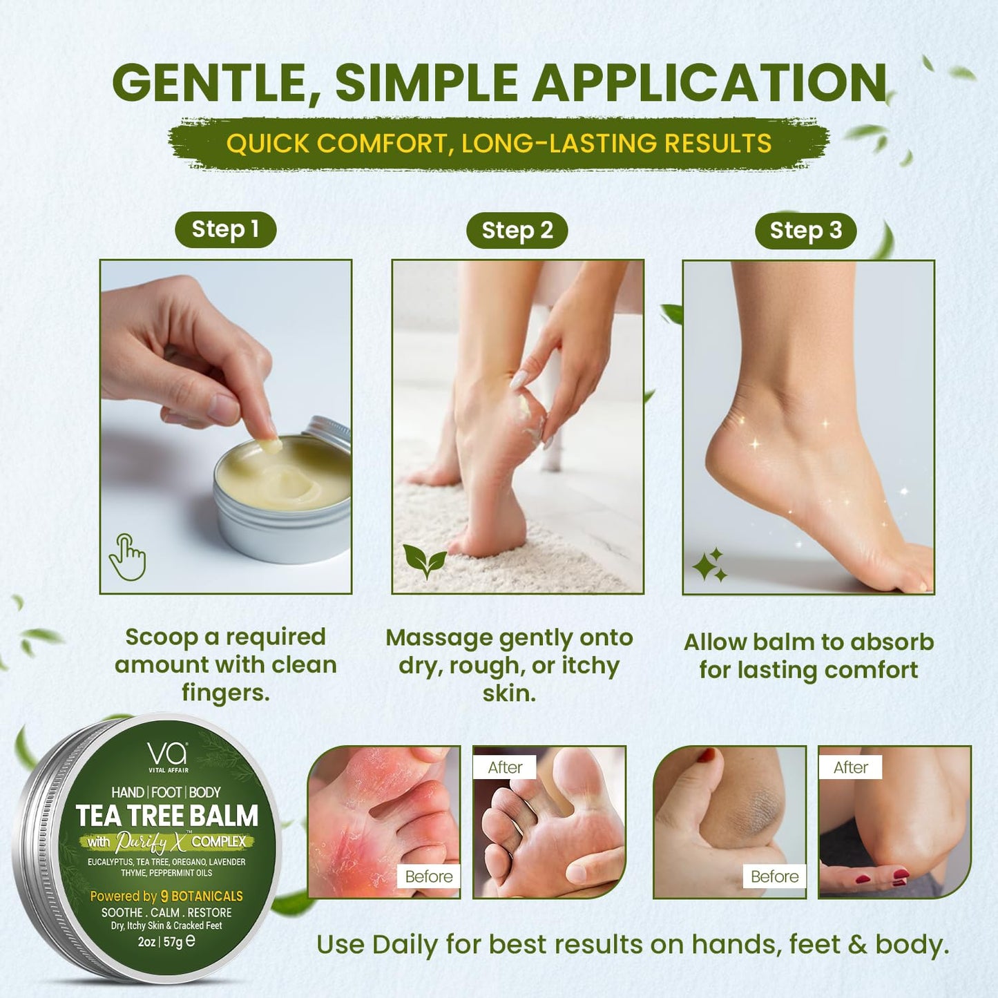 Tea Tree Oil Balm - Soothing Relief for Rashes, Athlete’s Foot & Bug Bites | 2 oz - Gentle for All Ages
