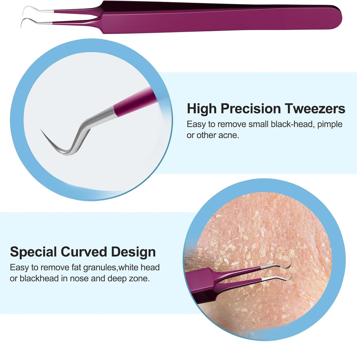 Blackhead Remover Tool Kit - Deep Cleaning Face Scraper & Pimple Popper | Skin Scrubber Spatula for Men & Women (Rose Red)