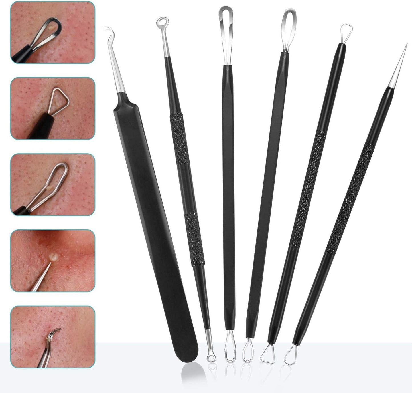 Blackhead Remover Tool Kit - 6-Piece Professional Stainless Steel Comedone Extractors