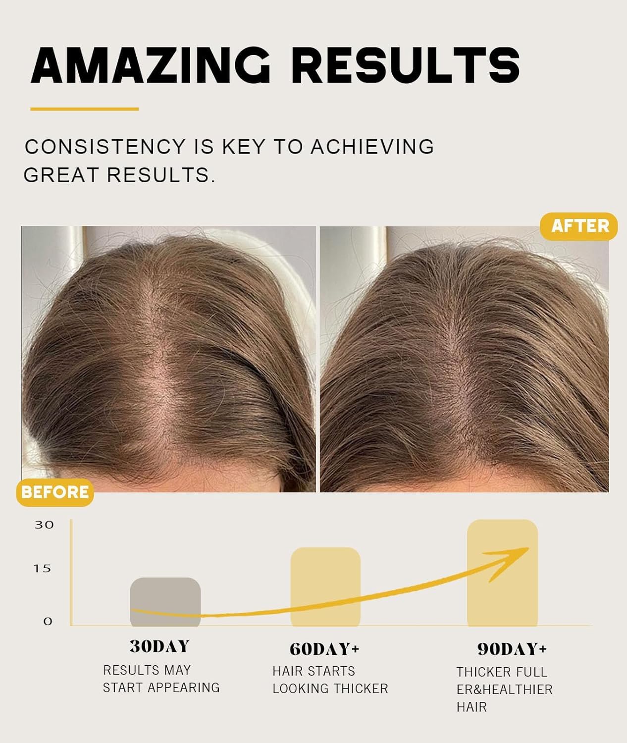Batana Oil for Hair Growth - 100% Natural Pure Scalp Mask | Prevents Hair Loss & Enhances Thickness (4.05 Oz)