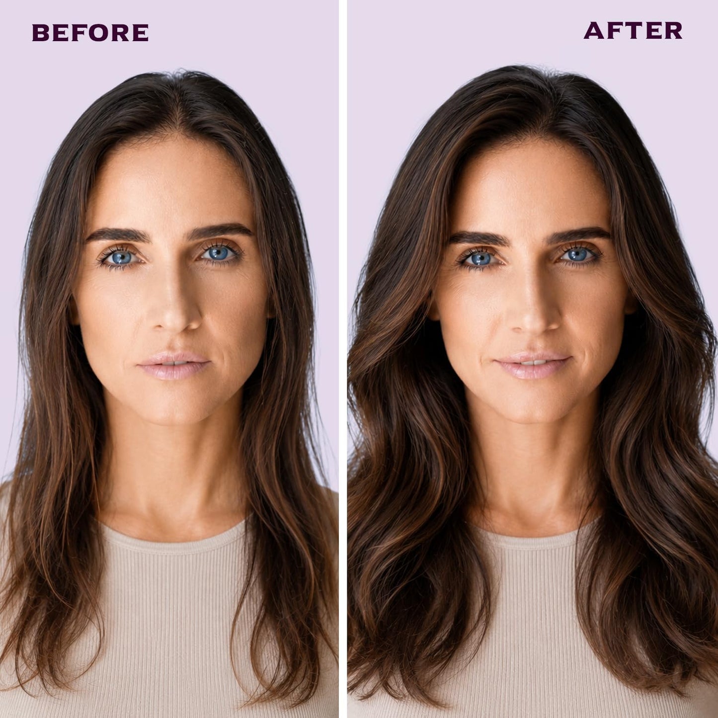 Hair Thickening Serum for Thinning Hair: Roll On Scalp Treatment with Rosemary Niacinamide & Salicylic Acid – Helps Reduce Hair Loss Due to Breakage Controls Oil – Korean Hair Care Metal Roller
