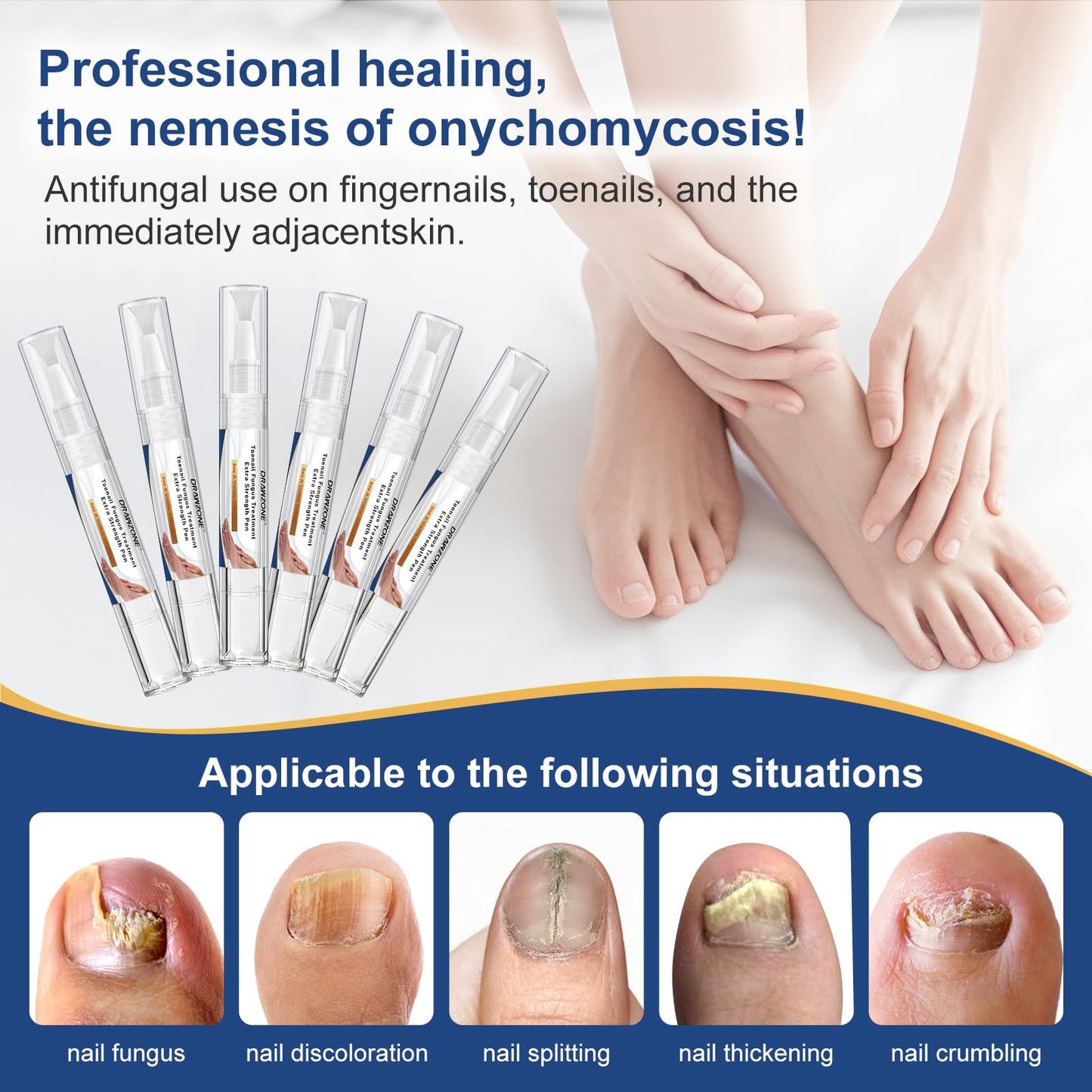 Toenail Fungi Treatment Extra Strength - Fungi Nail Pen, 25% Undecylenic Acid, Ingrown toenail treatment, Fungus nail treatment, yellow toenail, Damaged Nails foot fungus treatment extra strength