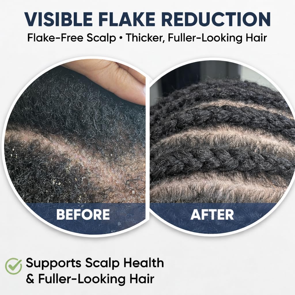 Hair Growth Elixir - Advanced Serum for Thicker, Fuller Hair | Dandruff Relief & Itch Relief | Oil-Free, Vegan