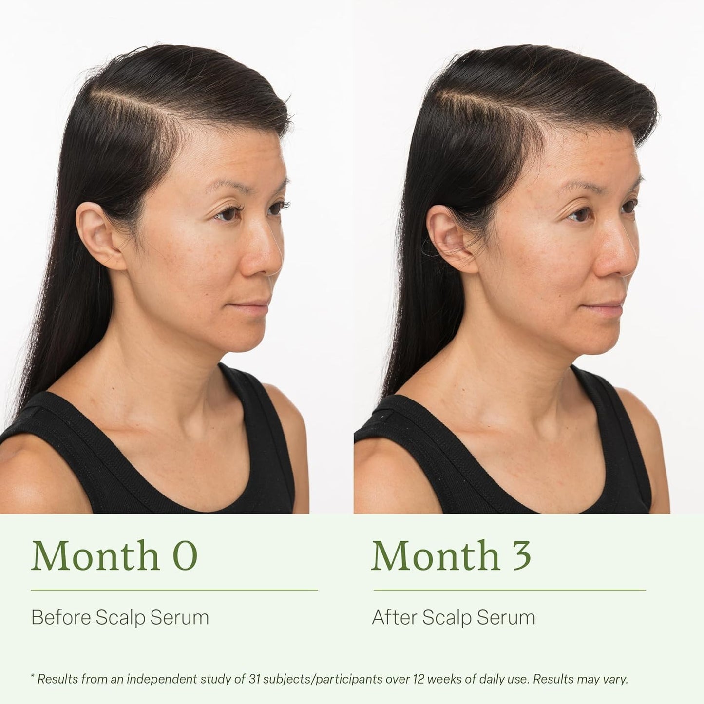 Divi Scalp Serum - Thinning Hair Treatment with Amino Acids, Caffeine & Rosemary Oil | Non-Greasy Formula for Healthy Scalp & Fuller Hair