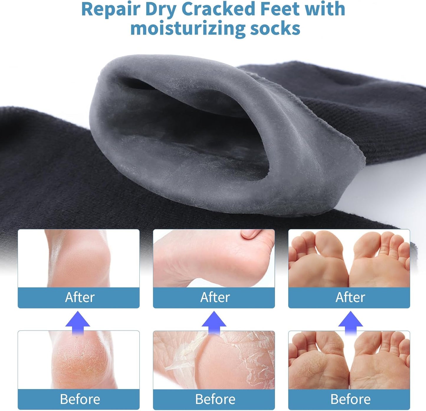 Silicone Moisturizing Socks for Men - Soft Foot Care for Dry, Cracked Feet | Size L (11”)