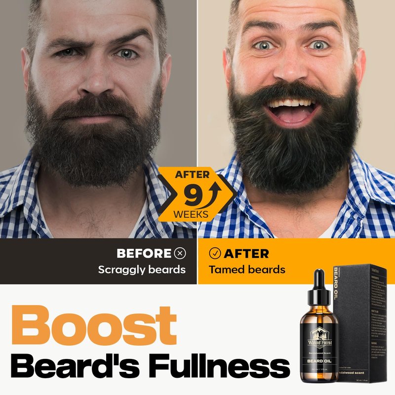 Waking Forest Sandalwood Beard Oil for Men - Biotin Mustache Oil with Vitamin E, Rosemary & Castor - Beard Care Softener, Strengthens, and Moisturizes - Beard Conditioner (1 Oz)