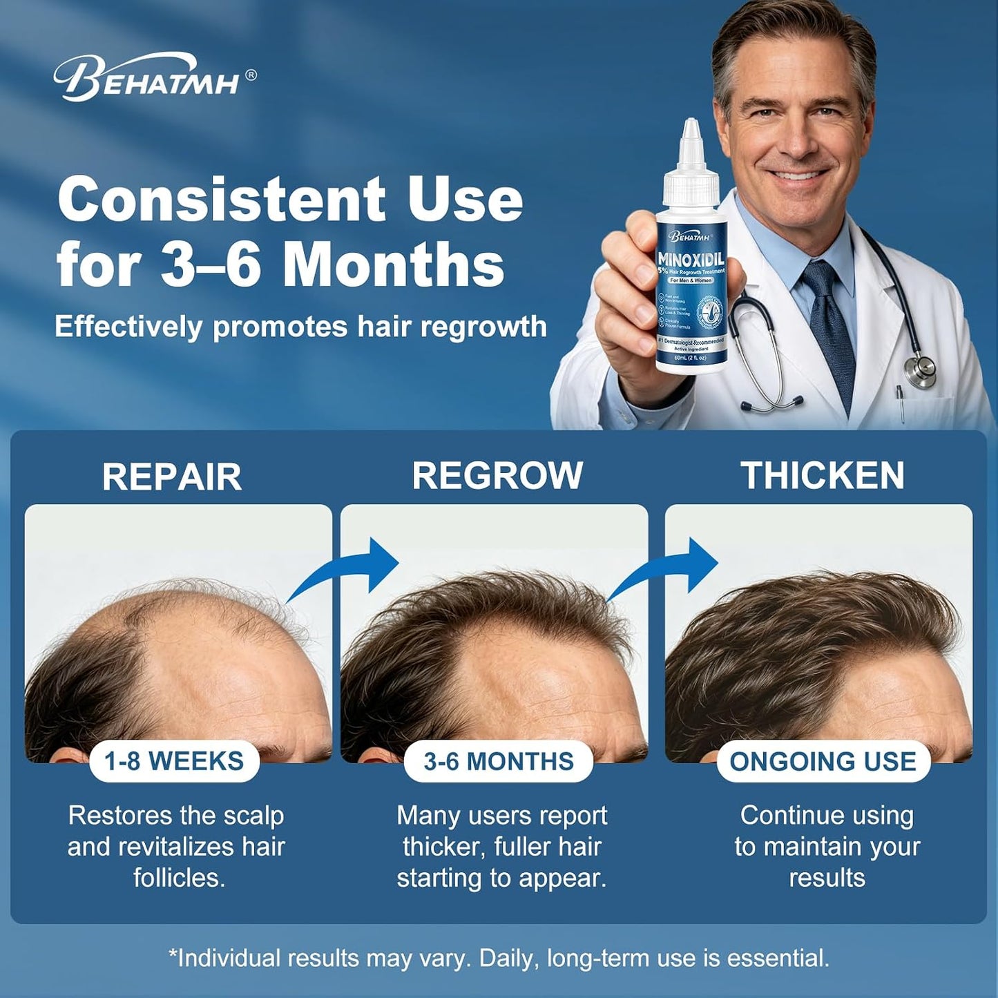 Minoxidil Hair & Beard Growth Serum - 5% Formula with Biotin & Castor Oil | 8-Pack for Thicker, Fuller Hair