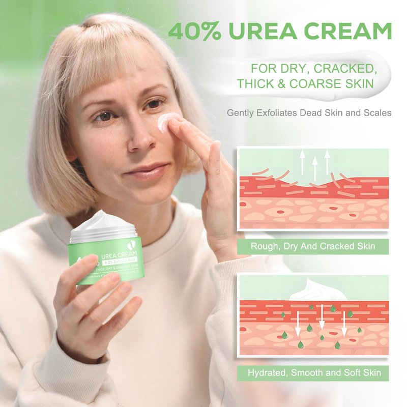 Mariayu Urea Cream 40%, with 2% Salicylic Acid 4.23 oz, Powerful Softening of Cracked Heels, Quick Absorption, Urea Foot Cream for Dry Heels, Hands, Feet, Knees & Elbows