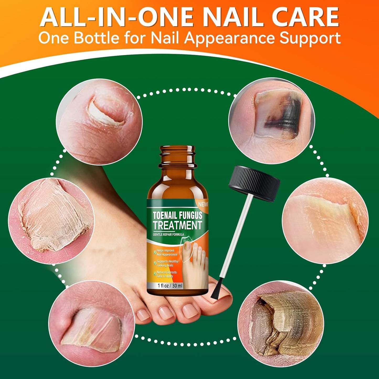 Toenail Fungus Treatment - Extra Strength Nail Repair with Tea Tree Oil, Menthol & Vitamin E | 1 fl oz