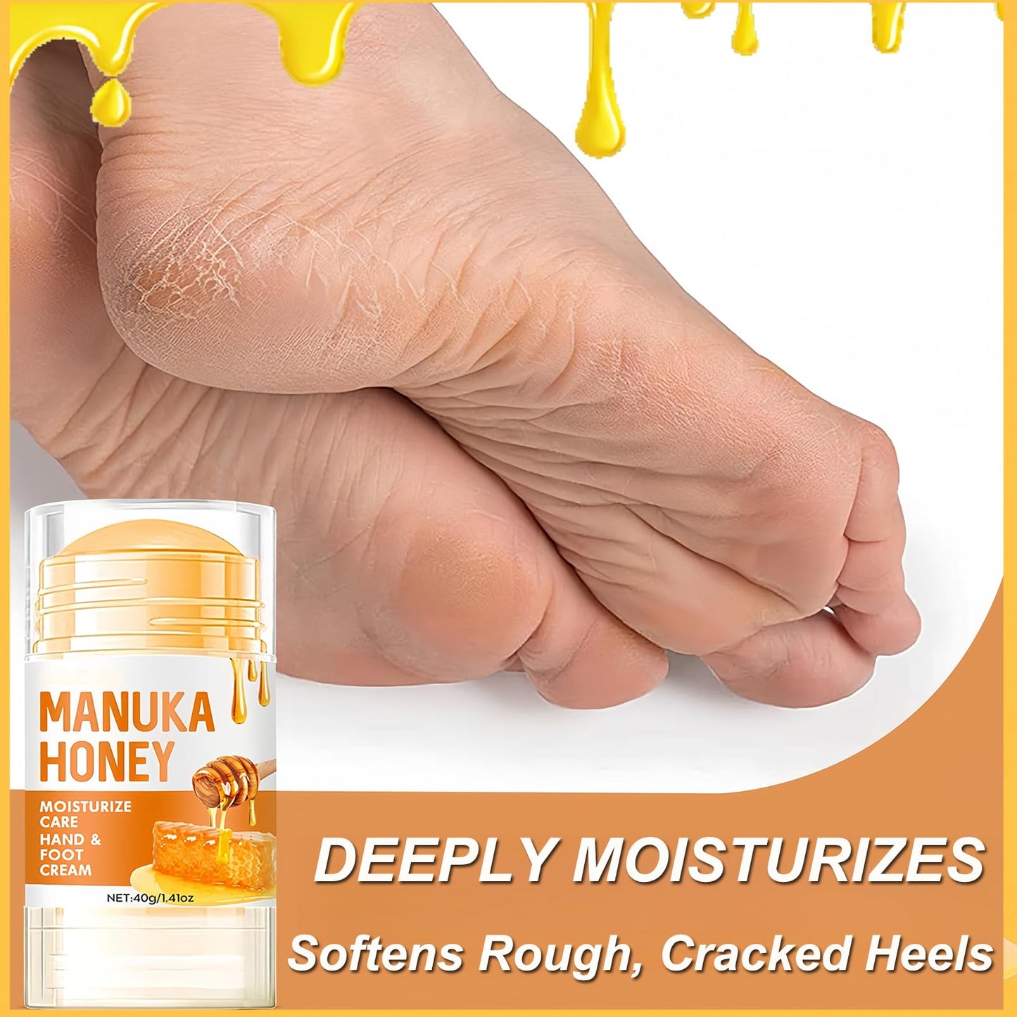 KAHSOSE 2Pcs Manuka Honey Foot Balm Stick, Moisturizing Hand and Foot Cream for Dry Cracked Heels, Heel Stick Balm for Women & Men, Callus Hydrating Cream for Hands, Elbows & Knees