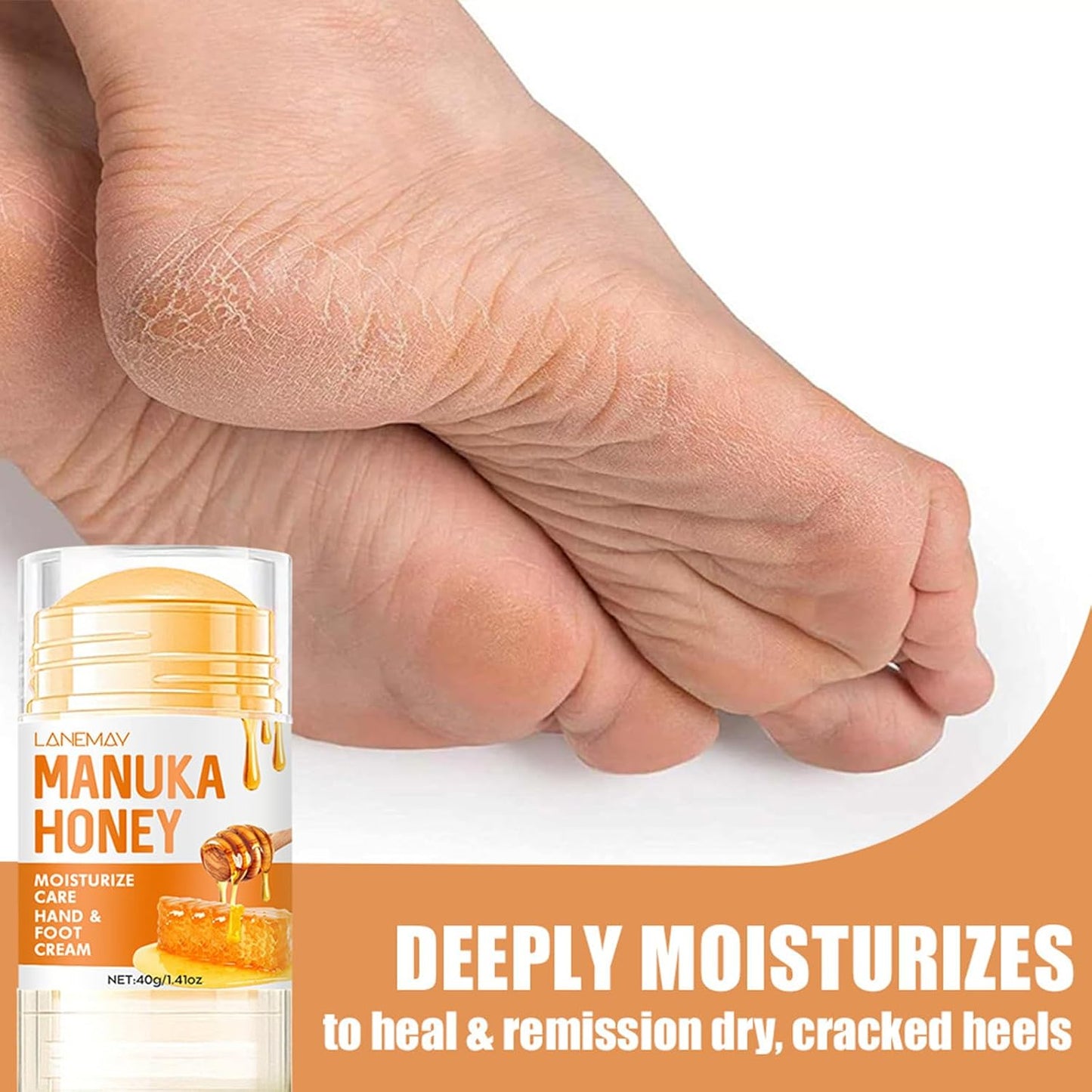 Honey Foot Balm Stick - Manuka Honey Moisturizing Cream for Dry, Cracked Heels & Feet | 1.41 Oz