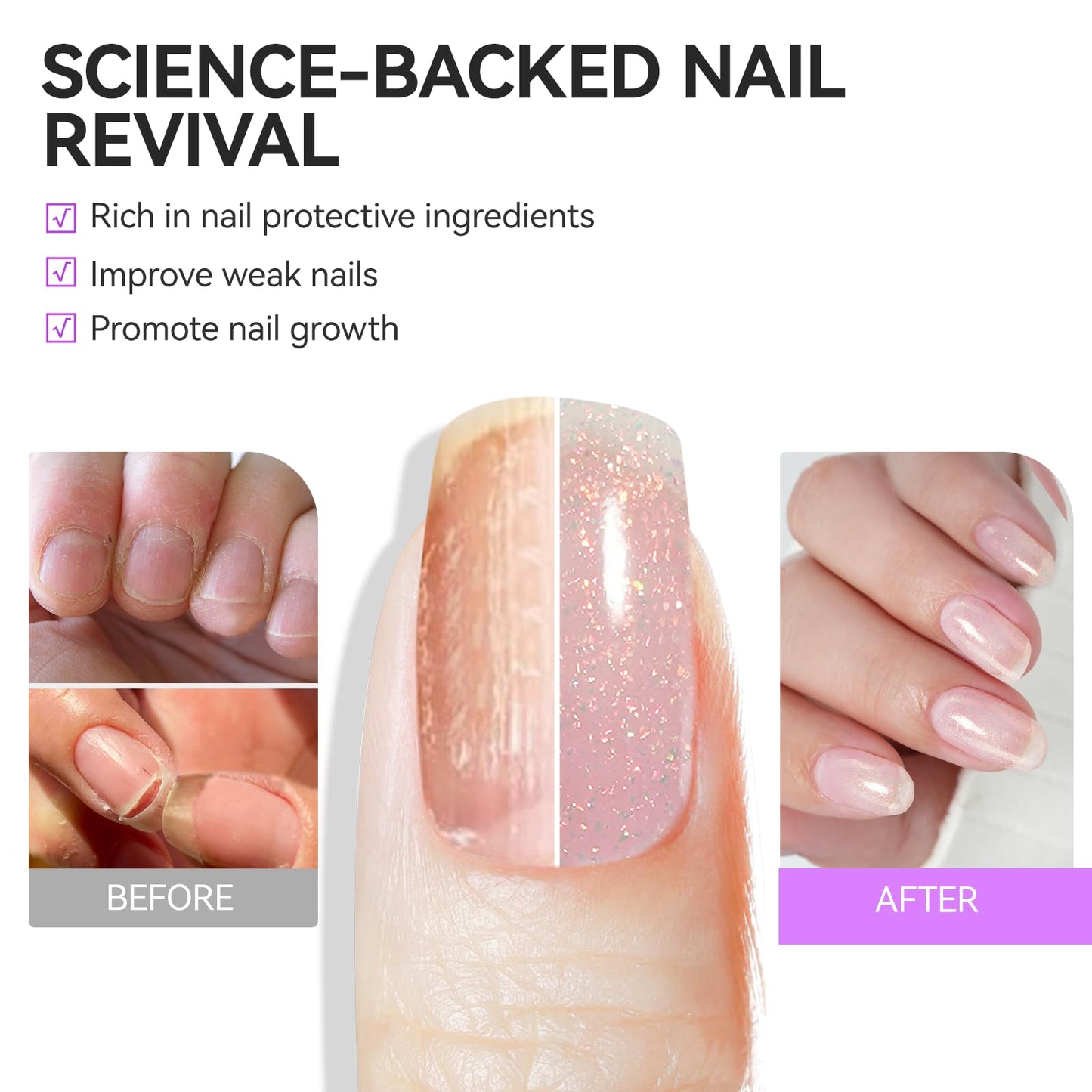 Nail Strengthener Protein for Damaged Nails: Pink 6 in 1 Natural Nail Hardener Extra Strong and Growth - Long Lasting Repair for Damaged Nails - PT