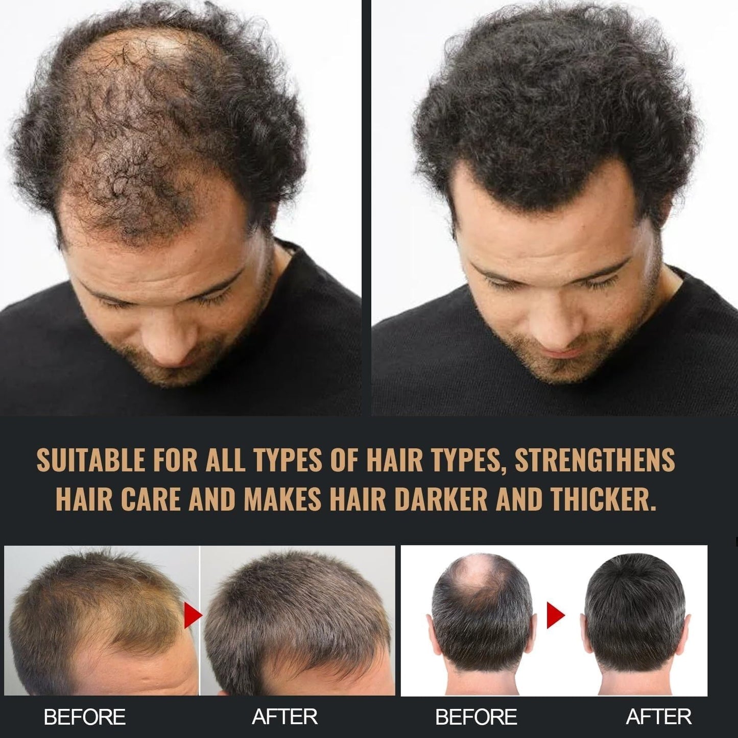 YUUCANGH Root Activator Shampoo for Men, Anti-Hair Loss Natural Formula