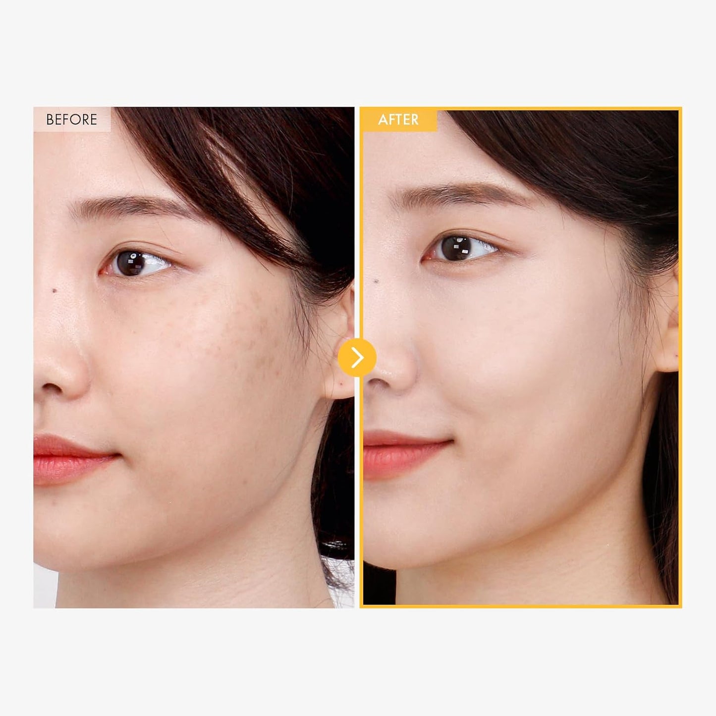 TOSOWOONG Dark Spot Remover Cream - Advanced Niacinamide Formula for Face | 50g (1.76 oz)