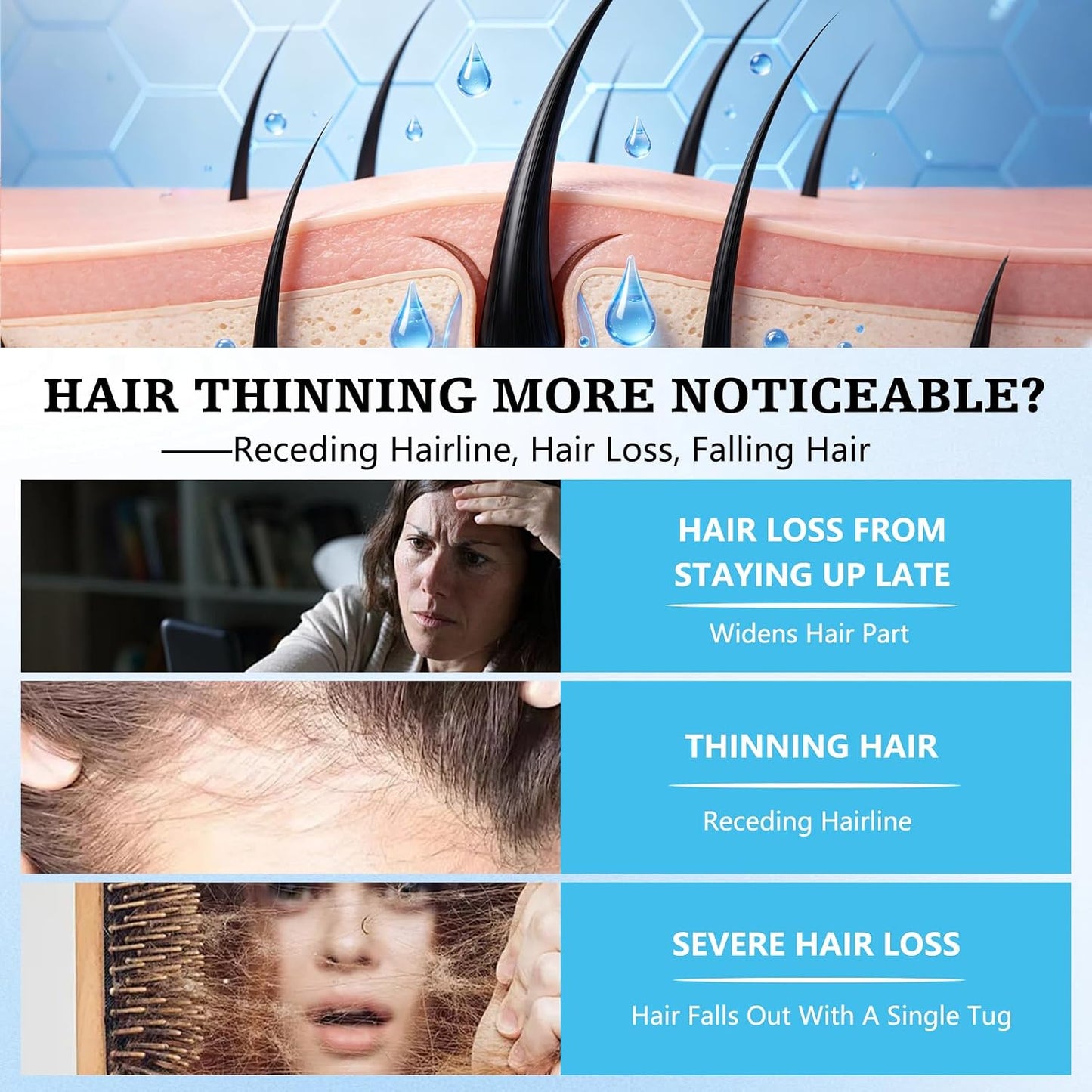 Minoxidil Shampoo for Hair Growth - Anti Hair Loss Treatment for Thinning Hair & Receding Hairline | 1 PCS
