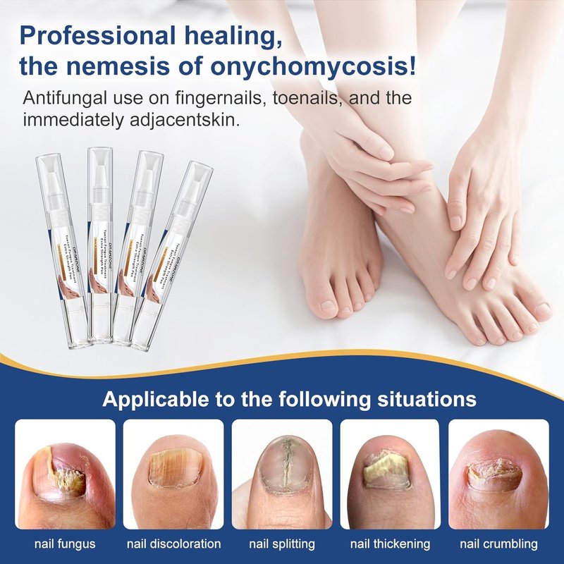 Toenail Fungi Treatment - Extra Strength Fungi Nail Pen with 25% Undecylenic Acid | Effective for Ingrown & Yellow Toenails