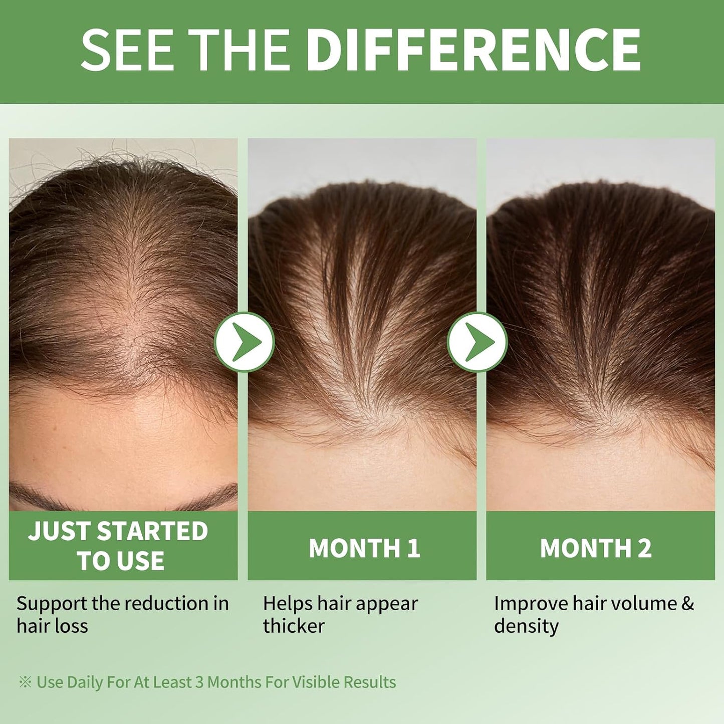 Rosemary Oil Hair Growth Serum - Hydrating Non-Greasy Scalp Treatment | 25ml Roller for Thicker Hair