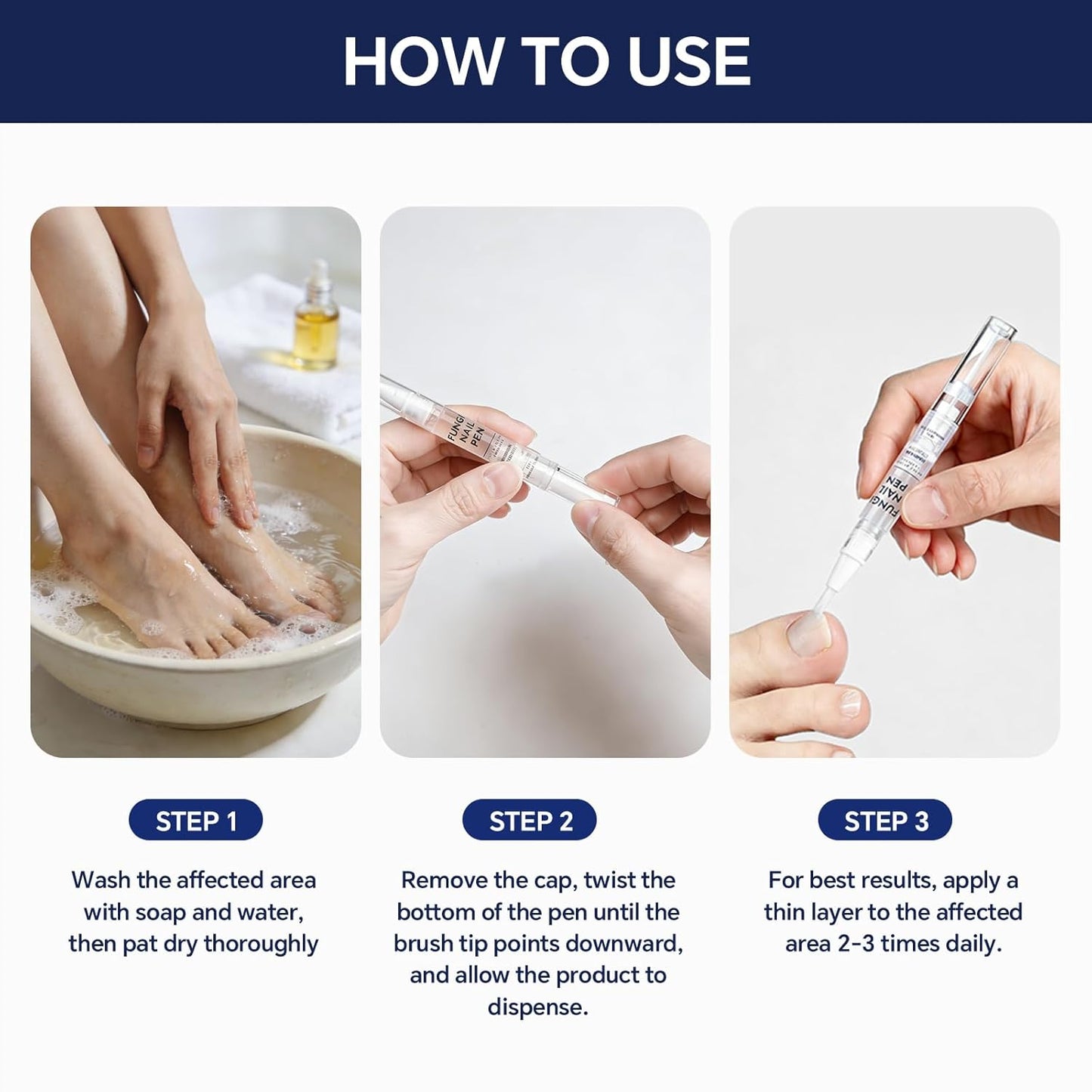 Toenail Fungus Treatment Pen - 25% Undecylenic Acid for Thick, Discolored Nails | 4 Pack