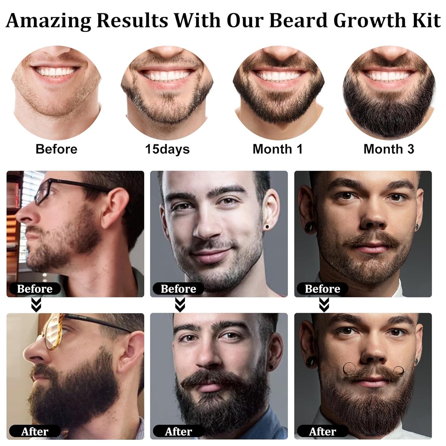 Beard Growth Kit - 2oz Beard Growth Oil with Biotin & Castor Oil for Fuller, Thicker Beard | Perfect Gift for Men
