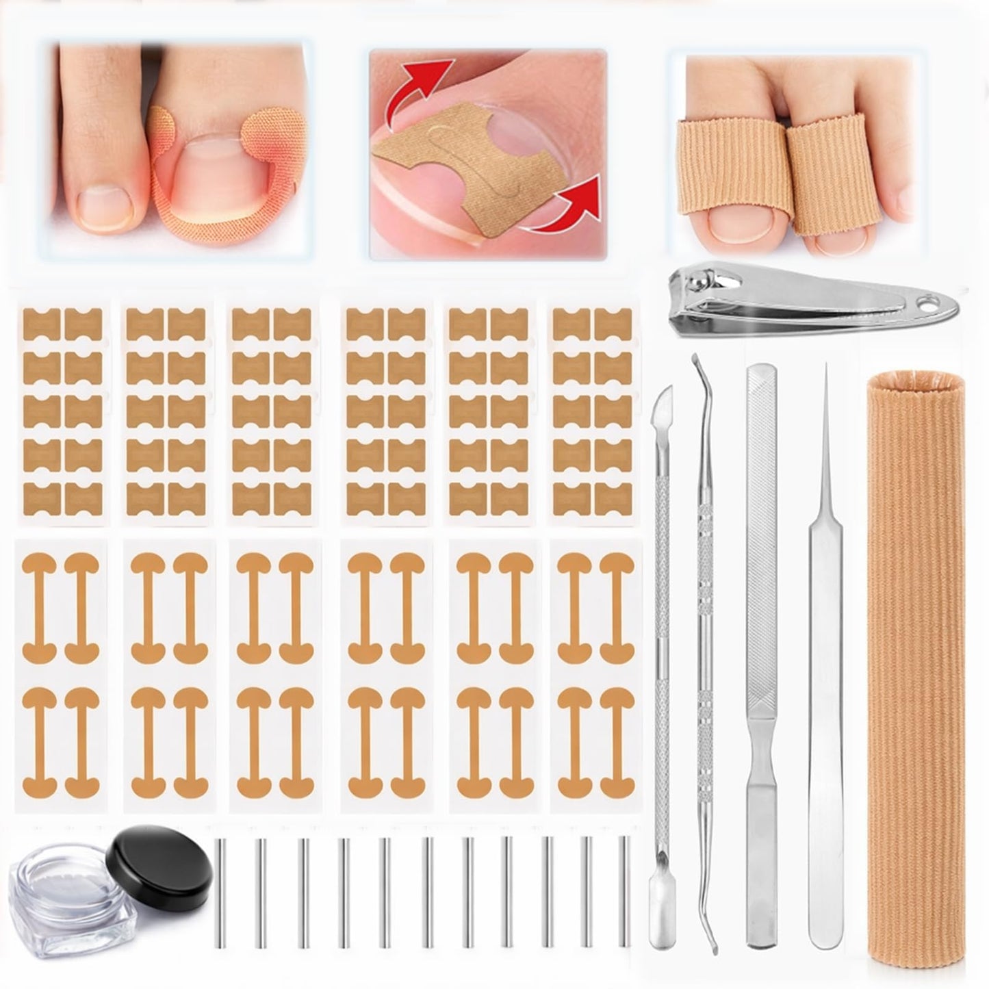 Ingrown Toenail Corrector & Toenail Correction Kit with Soft Breathable Strips, Stainless Steel Tools and Elastic Fiber Toe Sleeves; Ideal for Runners, Long-Hour Workers and Tight-Shoe Wearers