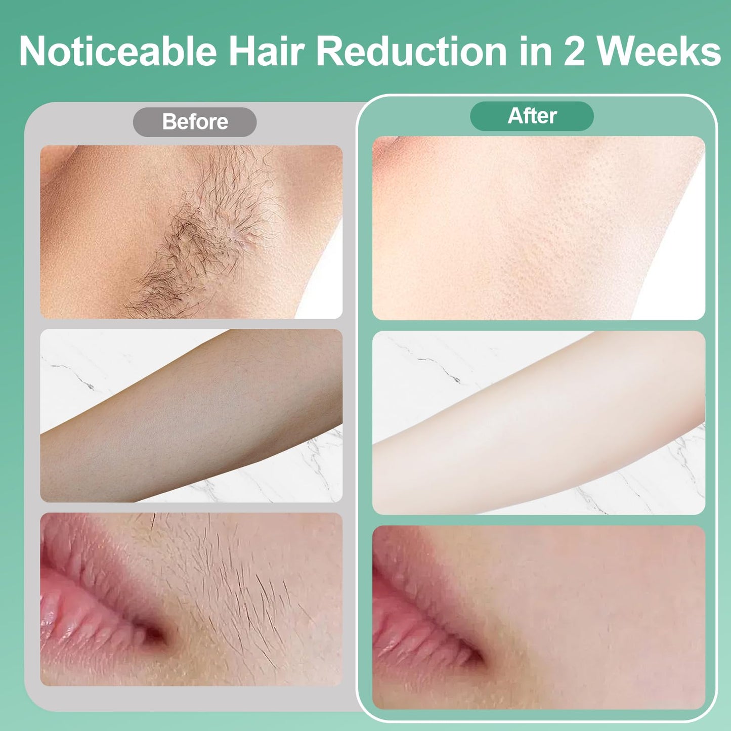 Lovsheme Sapphire Ice Cooling Hair Remove Device, Ice-cooling Device Hair Removal for Nearly Painless, Auto Flashing for Fast Full Body Hair Removal, White