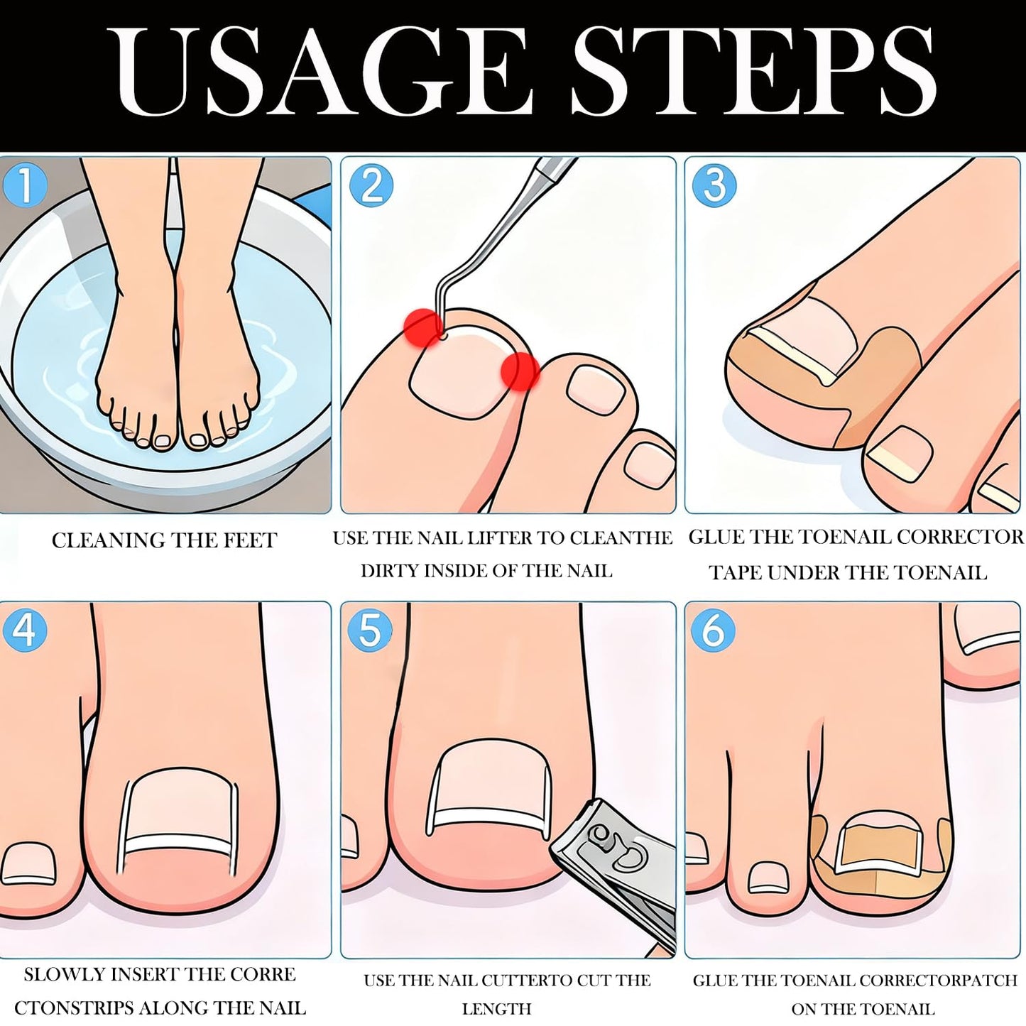 Ingrown Toenail Toolkit - Painless Curved Toenail Corrector with Breathable Strips & File | Home Pedicure Essential