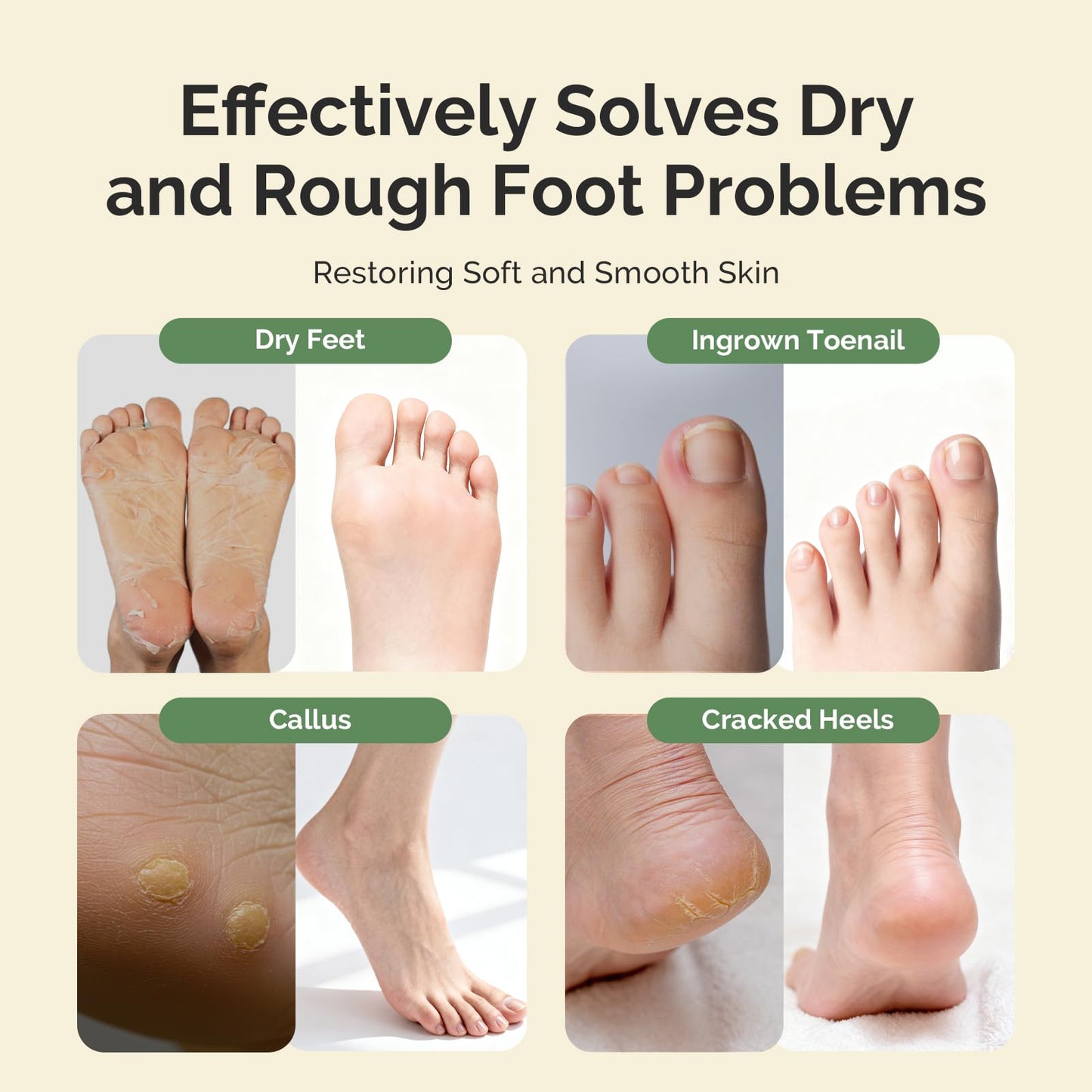 MelodySusie Tea Tree Oil Foot Soak with Sea Salt - Moisturizing Pedicure Treatment for Softening Calluses & Soothing Tired Feet - 16oz Relaxing Foot Bath to Refresh & Rejuvenate 1 Pound