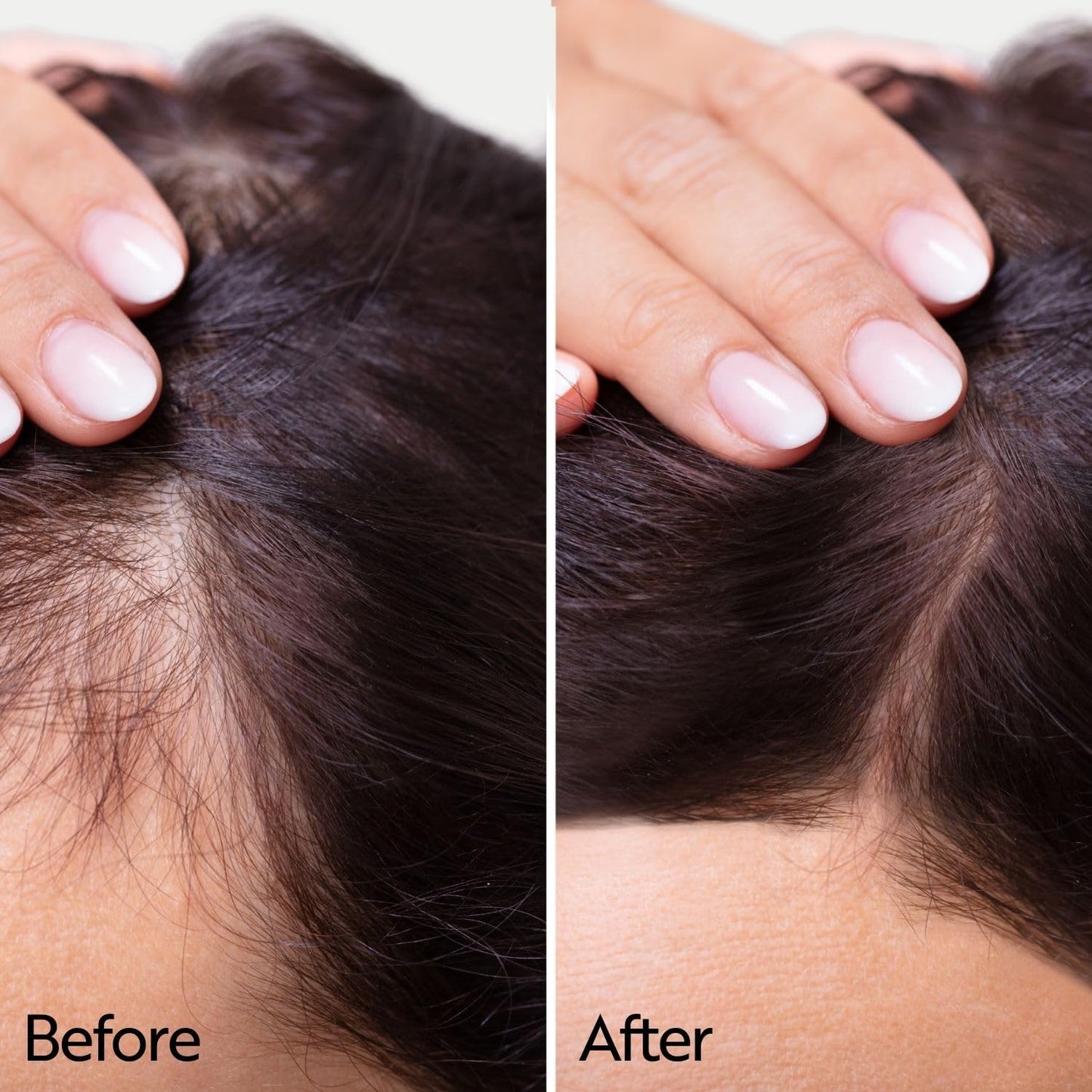 Ahuhu ESSENTIAL ANTI-AGE Elixir With Caffeine & Redensyl (100ml) - Highly Concentrated Scalp Care, Stimulates Hair Growth, Provides Thicker Hair & More Volume, Vegan