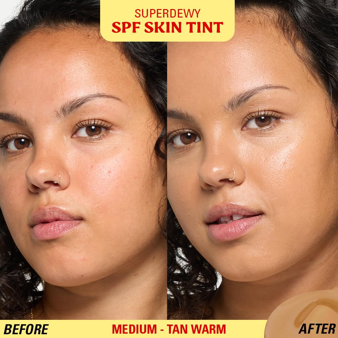 Revolution Superdewy SPF 30 Skin Tint - Tinted Mineral Foundation for Buildable Glow | Medium Tan Warm, Vegan & Cruelty-Free
