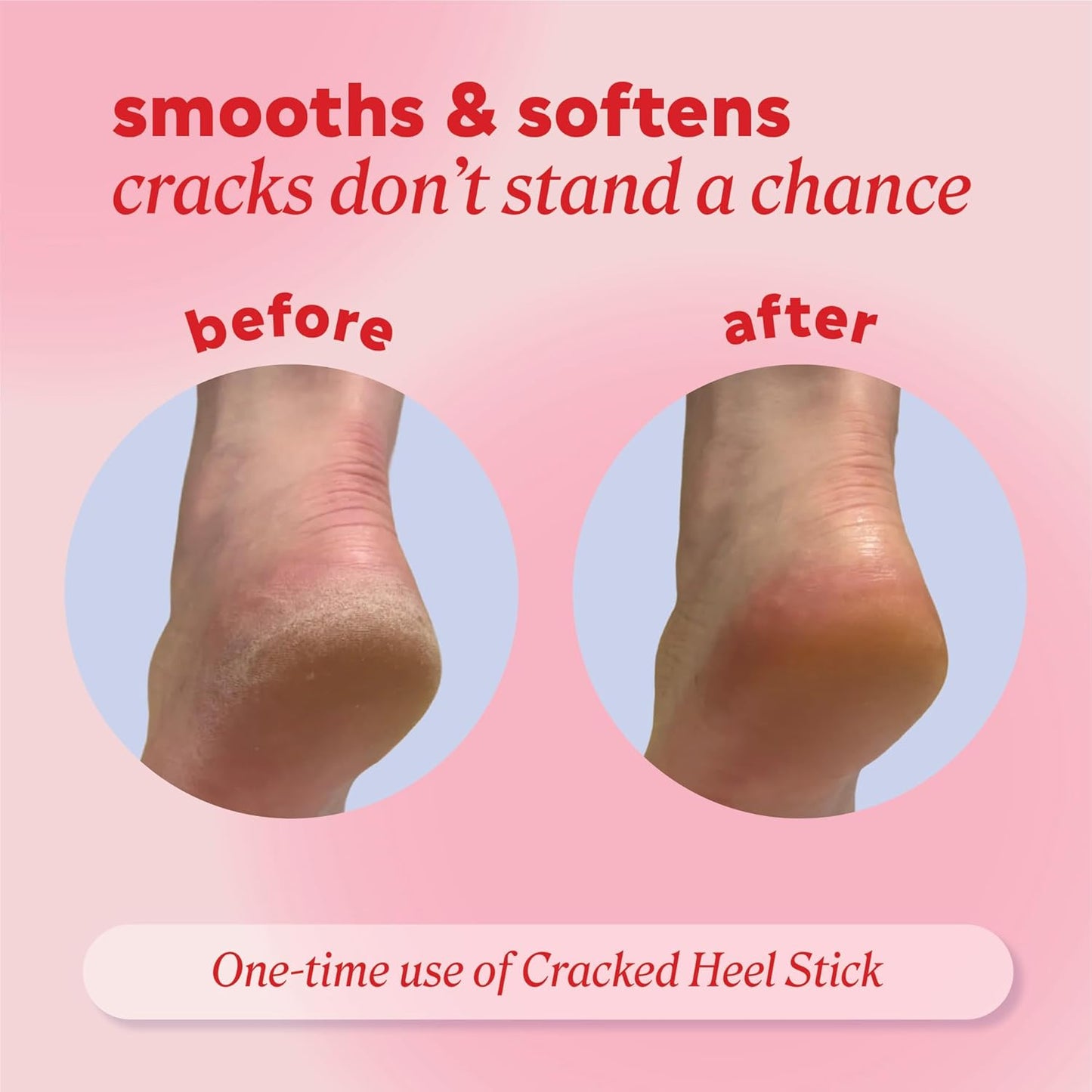 Onyx Cracked Heel Repair Balm Stick - Moisturizing Treatment for Dry Feet | Citrus Scent, 2-Pack