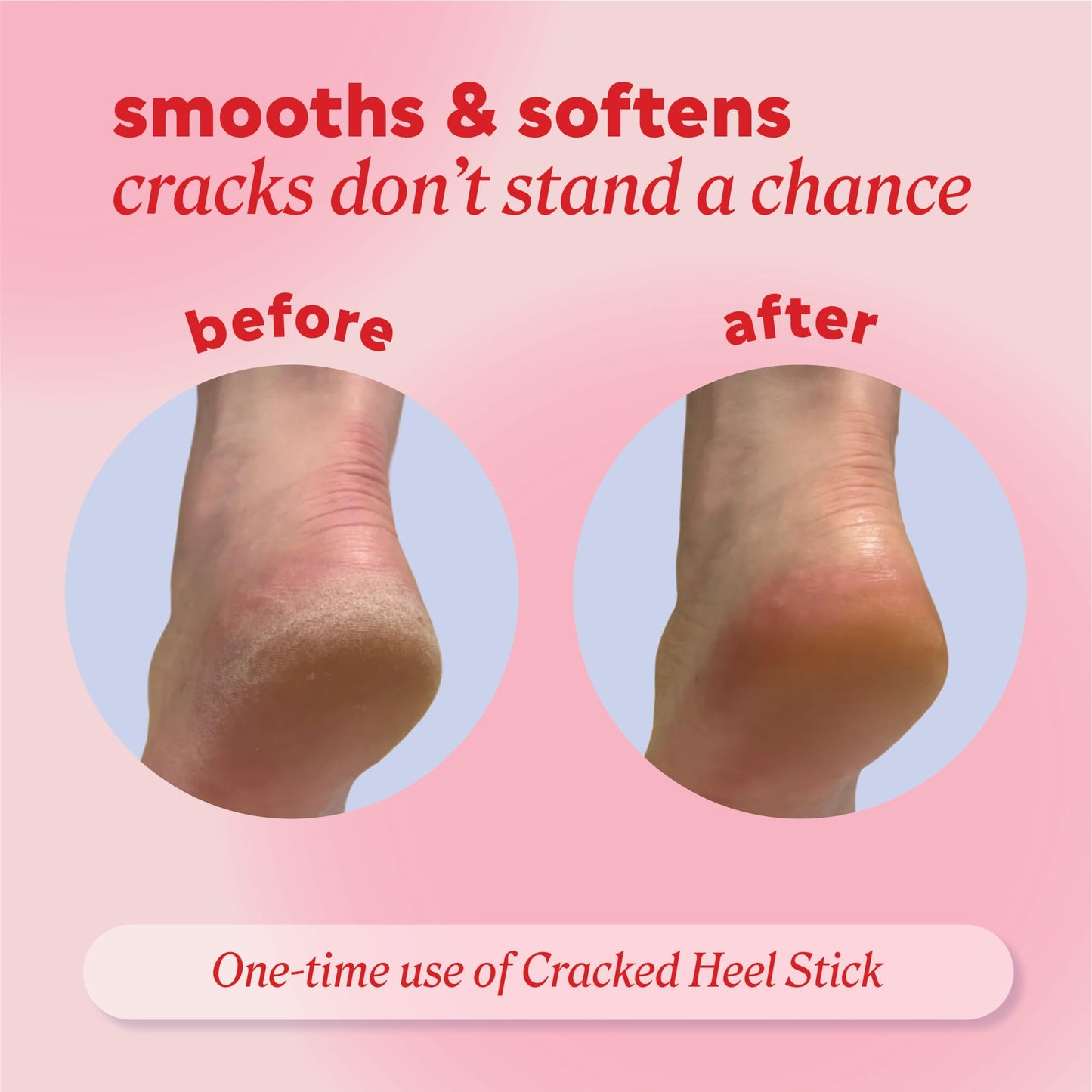 Onyx Professional Cracked Heel Repair Balm Stick for Dry Cracked Feet Treatment, Citrus Scent, 2 pack - Moisturizing Foot Balm, Rolls On, No Mess Like Foot Cream or Foot Lotion, Heel Treatment