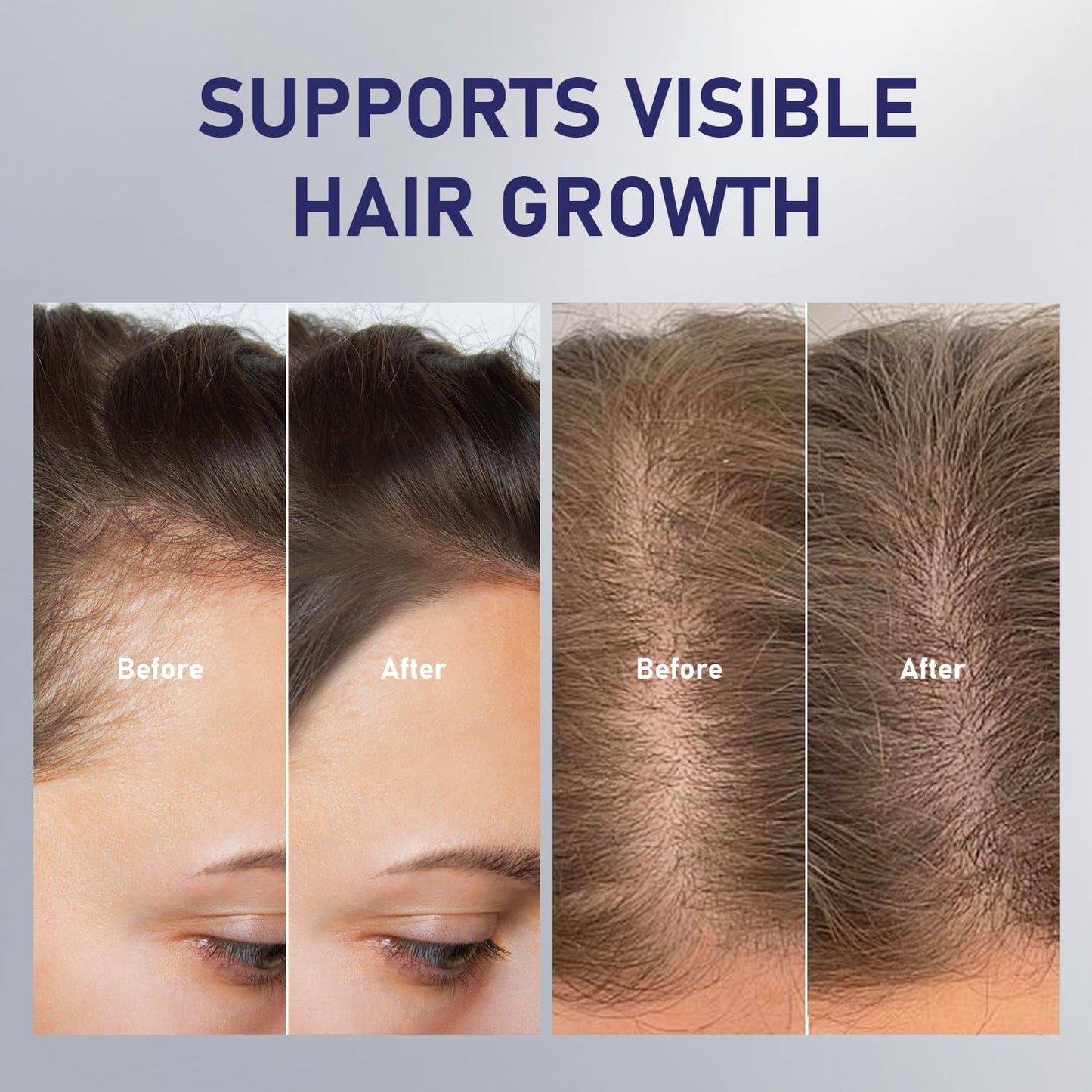 GHK-Cu Copper Peptide Hair Growth Spray for Fuller Thicker-Looking Hair
